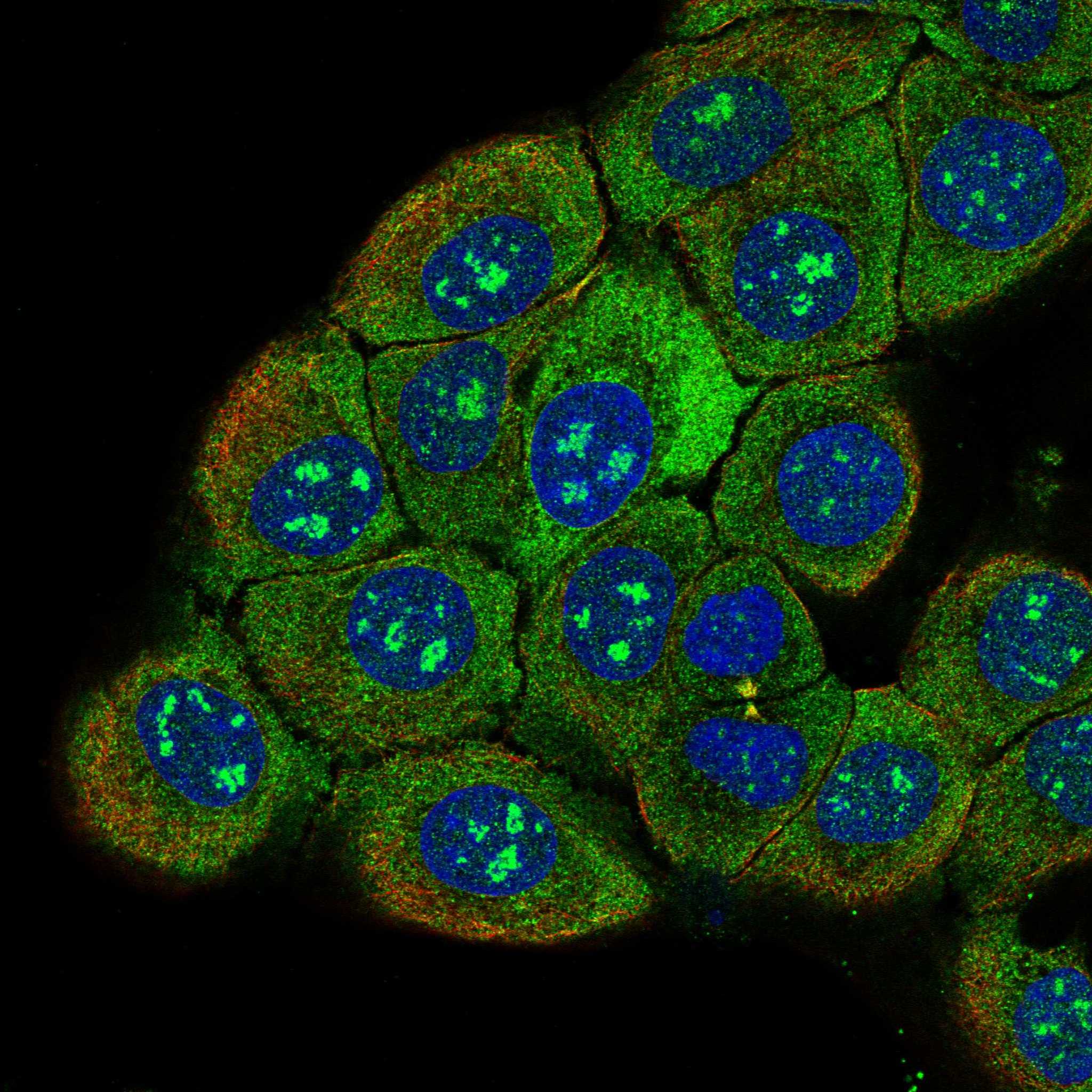 NALCN fluorescence