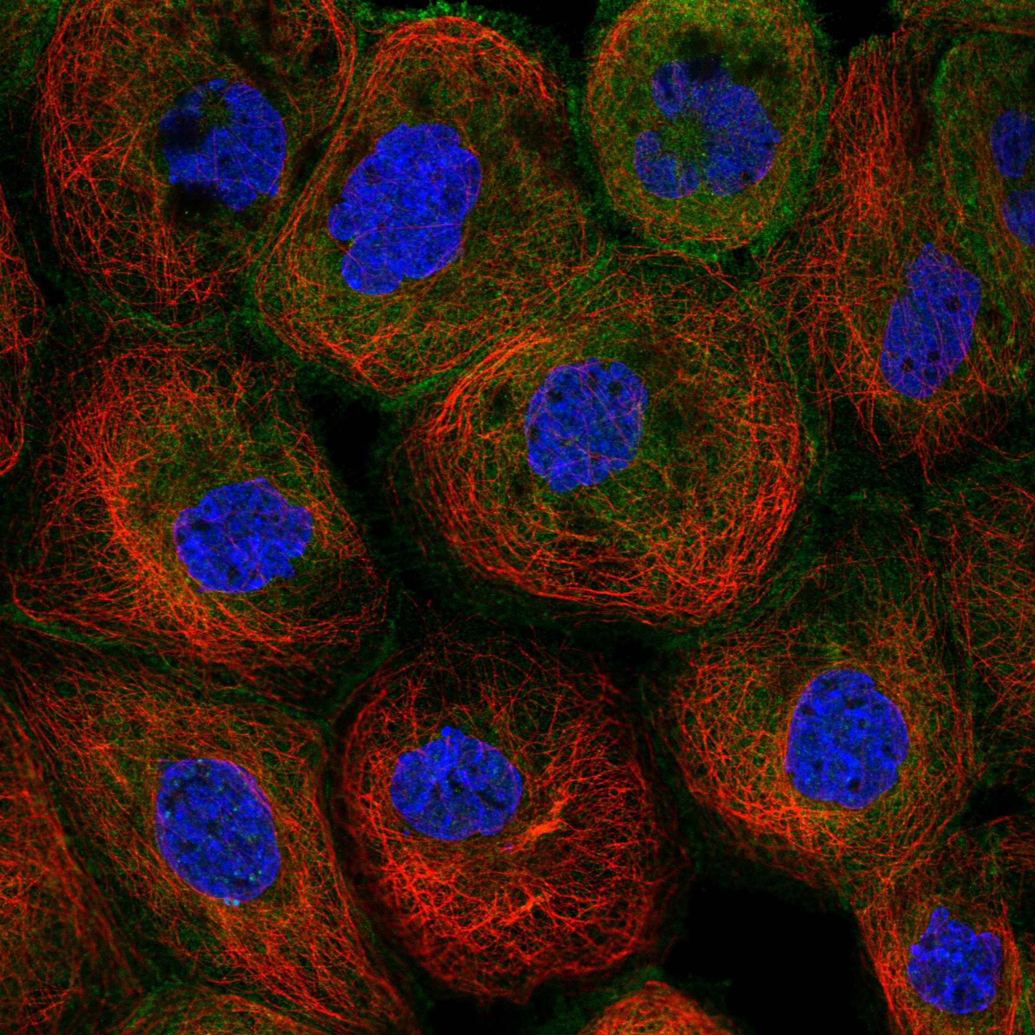 NCK1 fluorescence