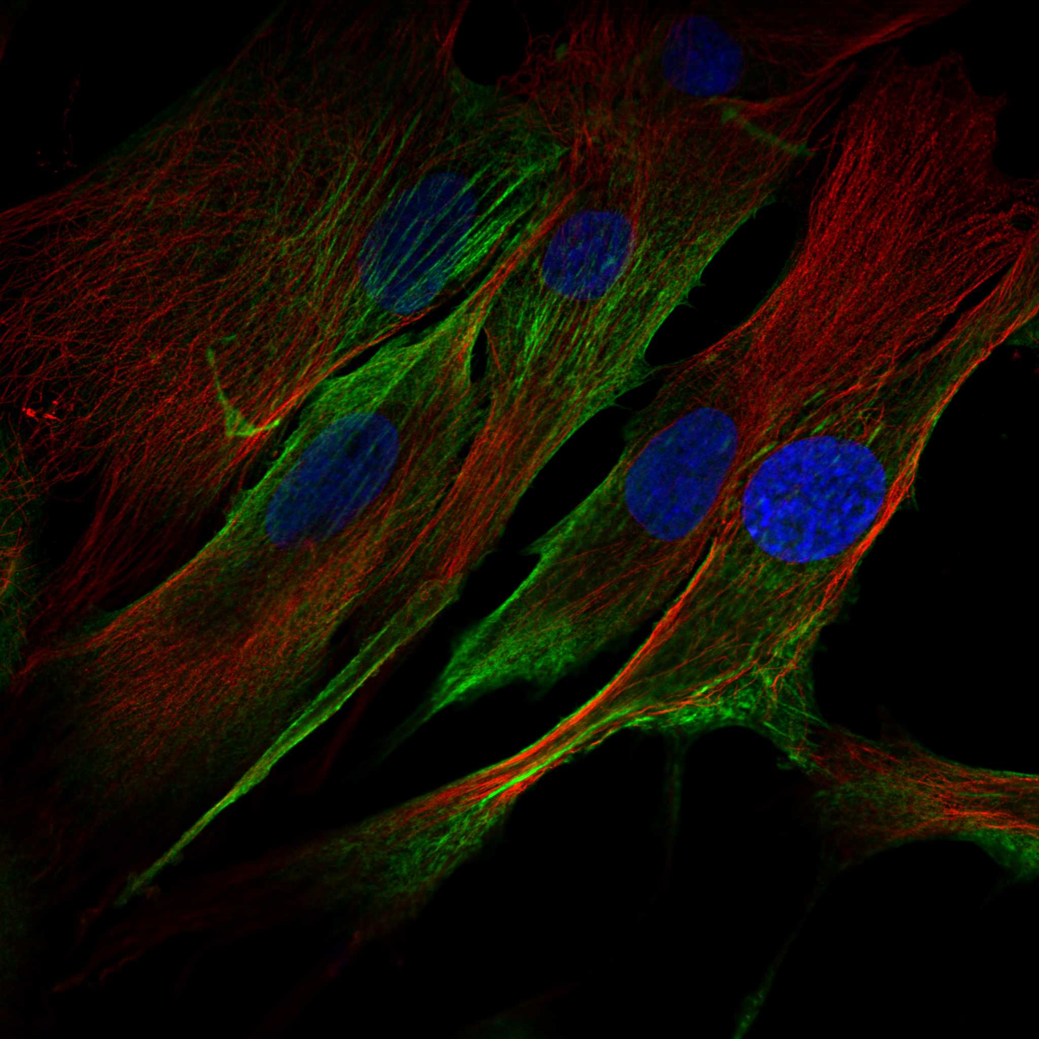 NEXN fluorescence