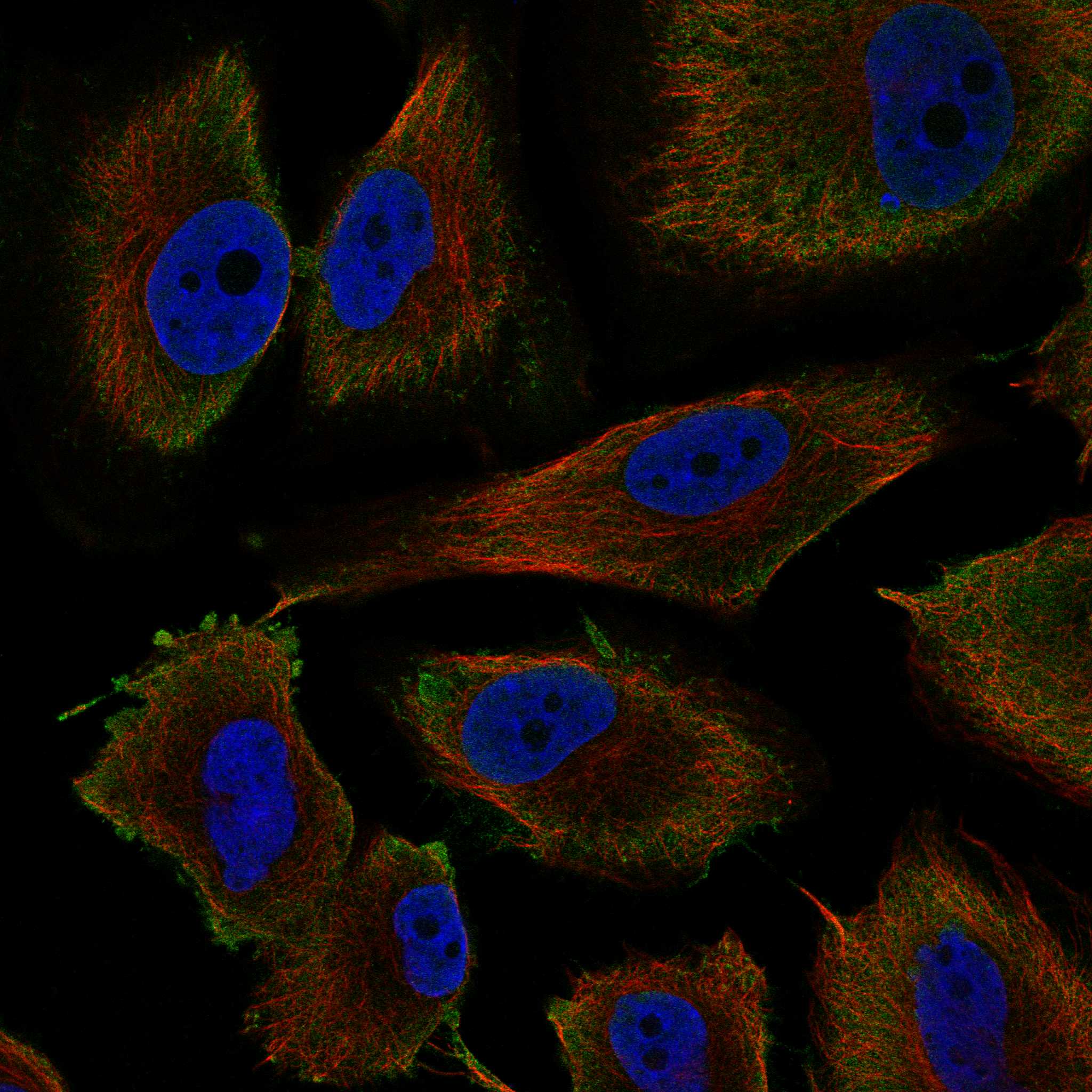 NF1 fluorescence
