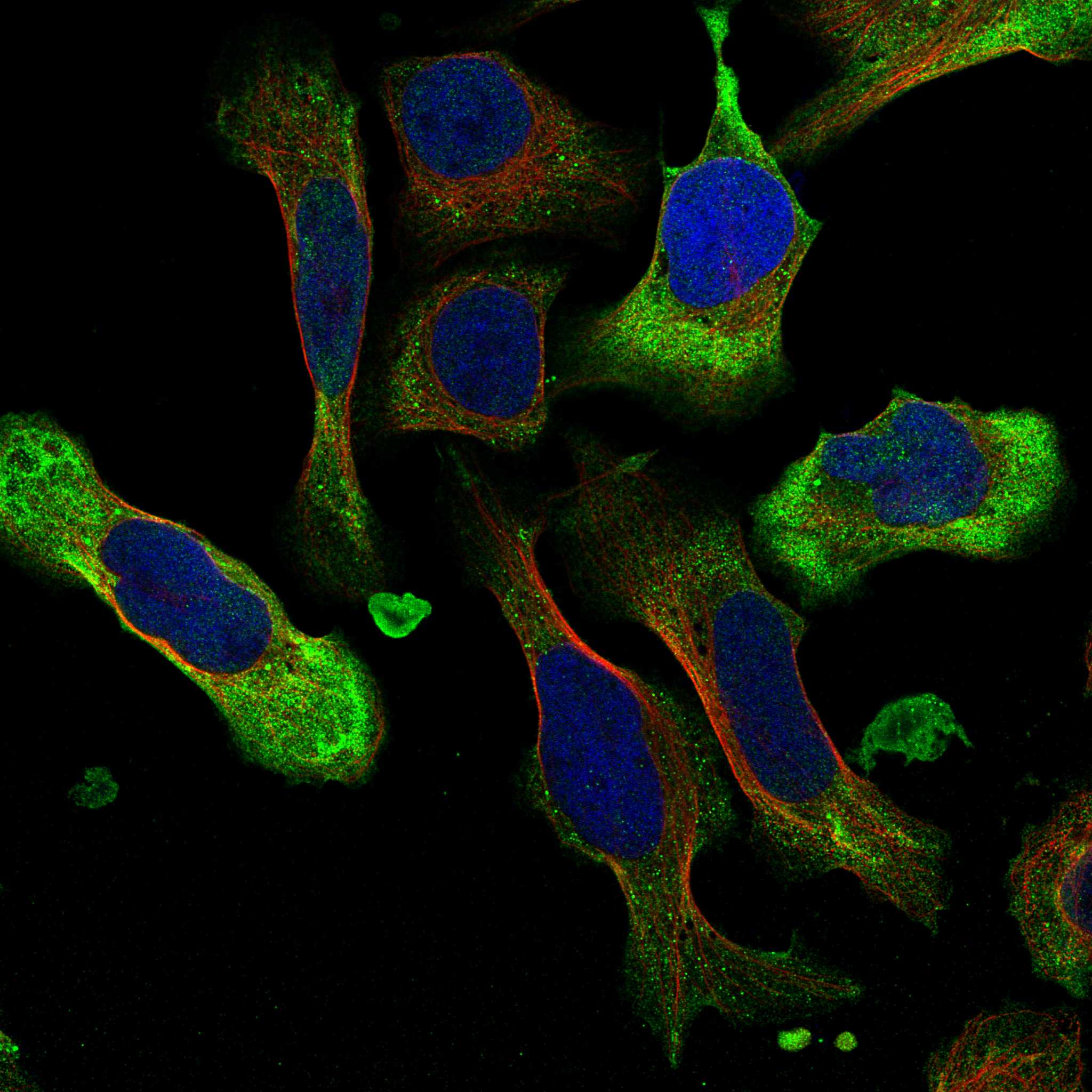 NMBR fluorescence
