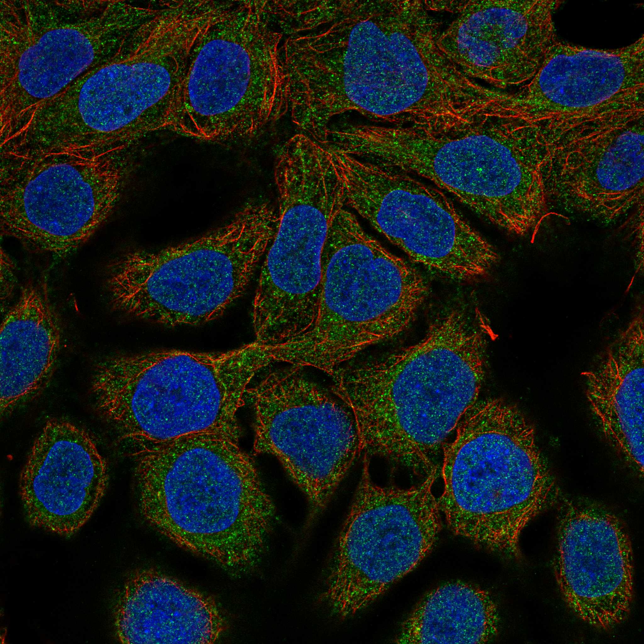 NPTXR fluorescence