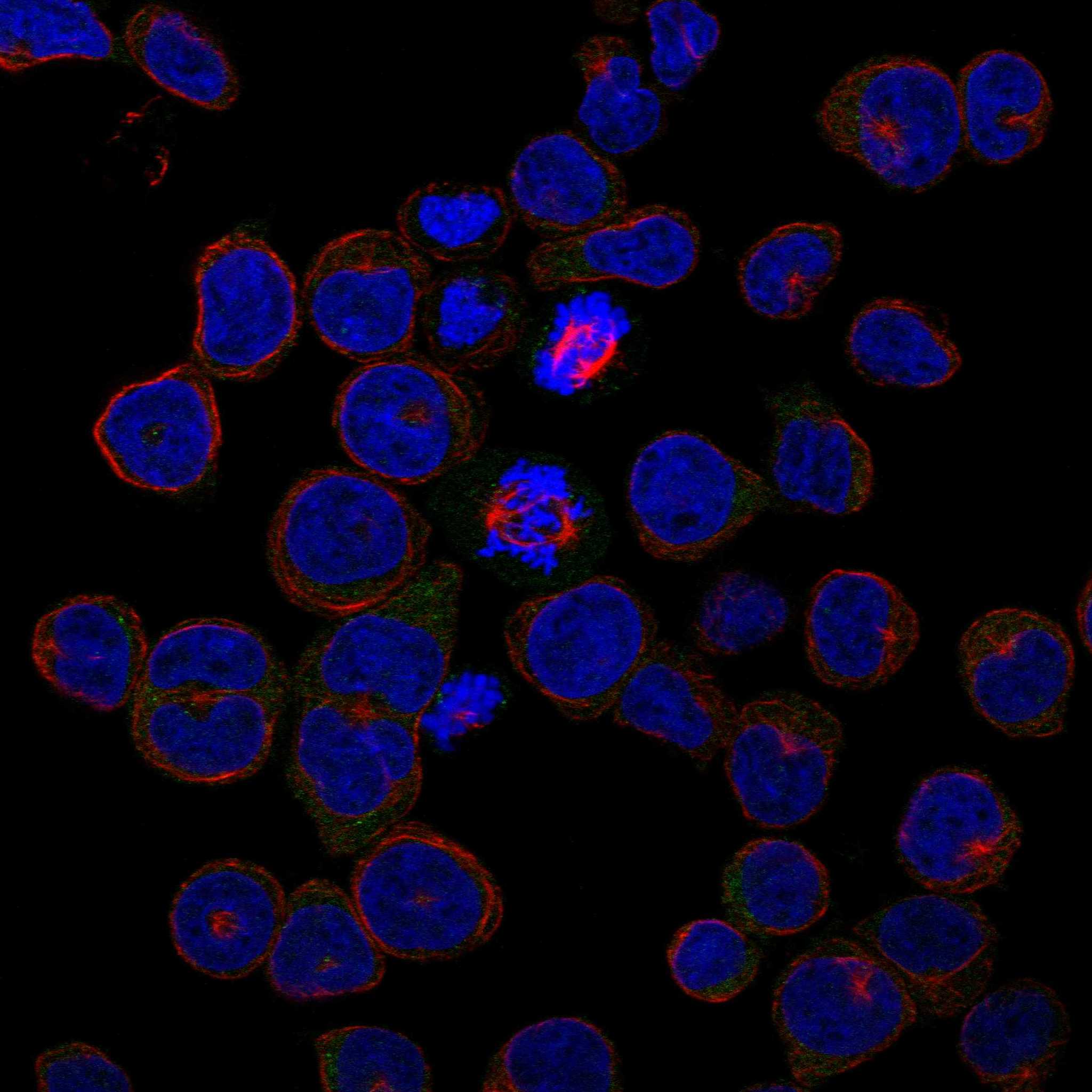 NTRK1 fluorescence