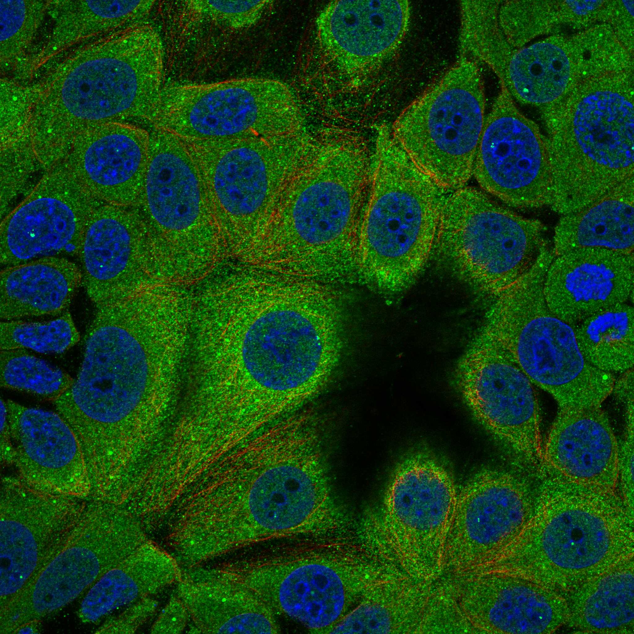 PACS1 fluorescence