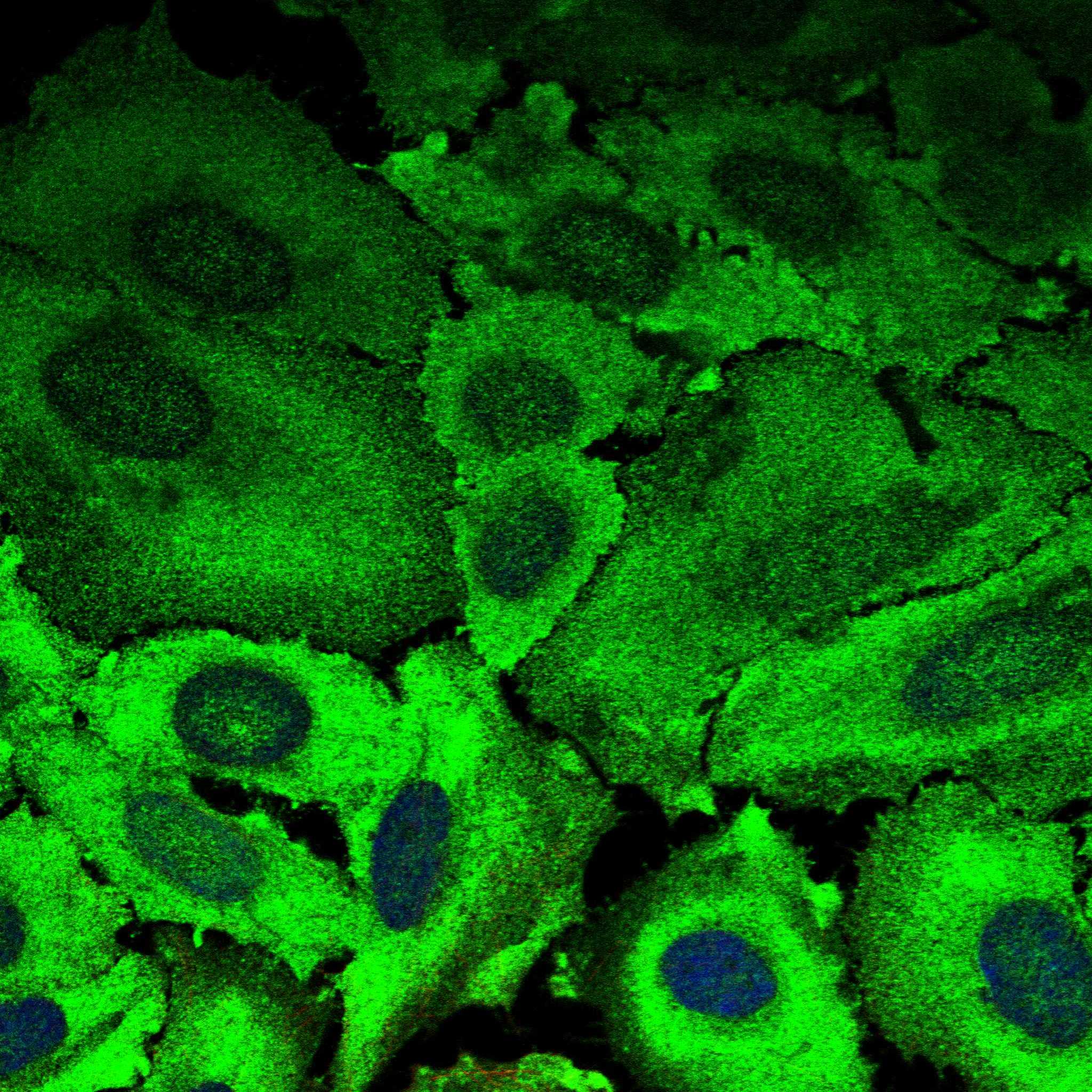 PAIP1 fluorescence