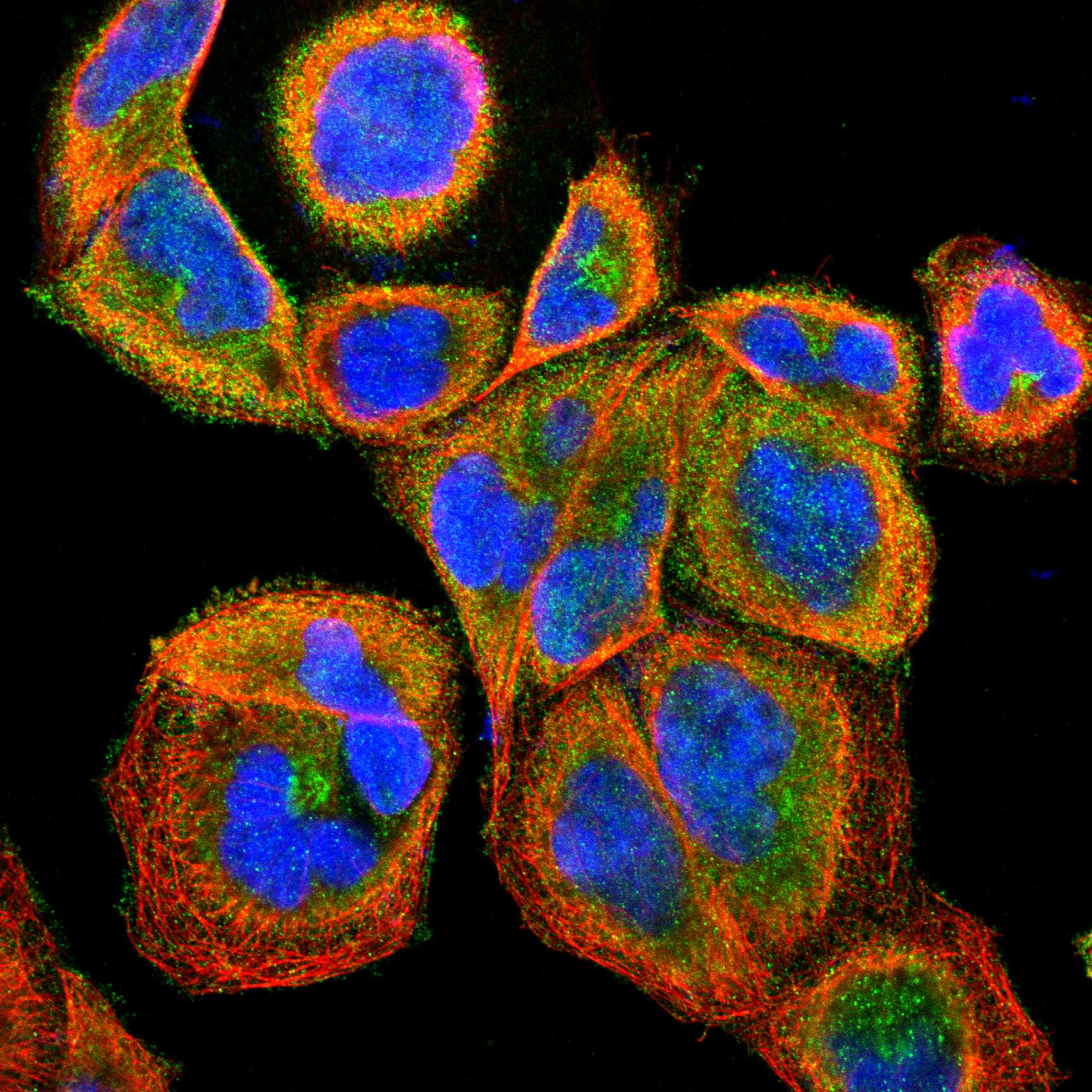 PAK1 fluorescence