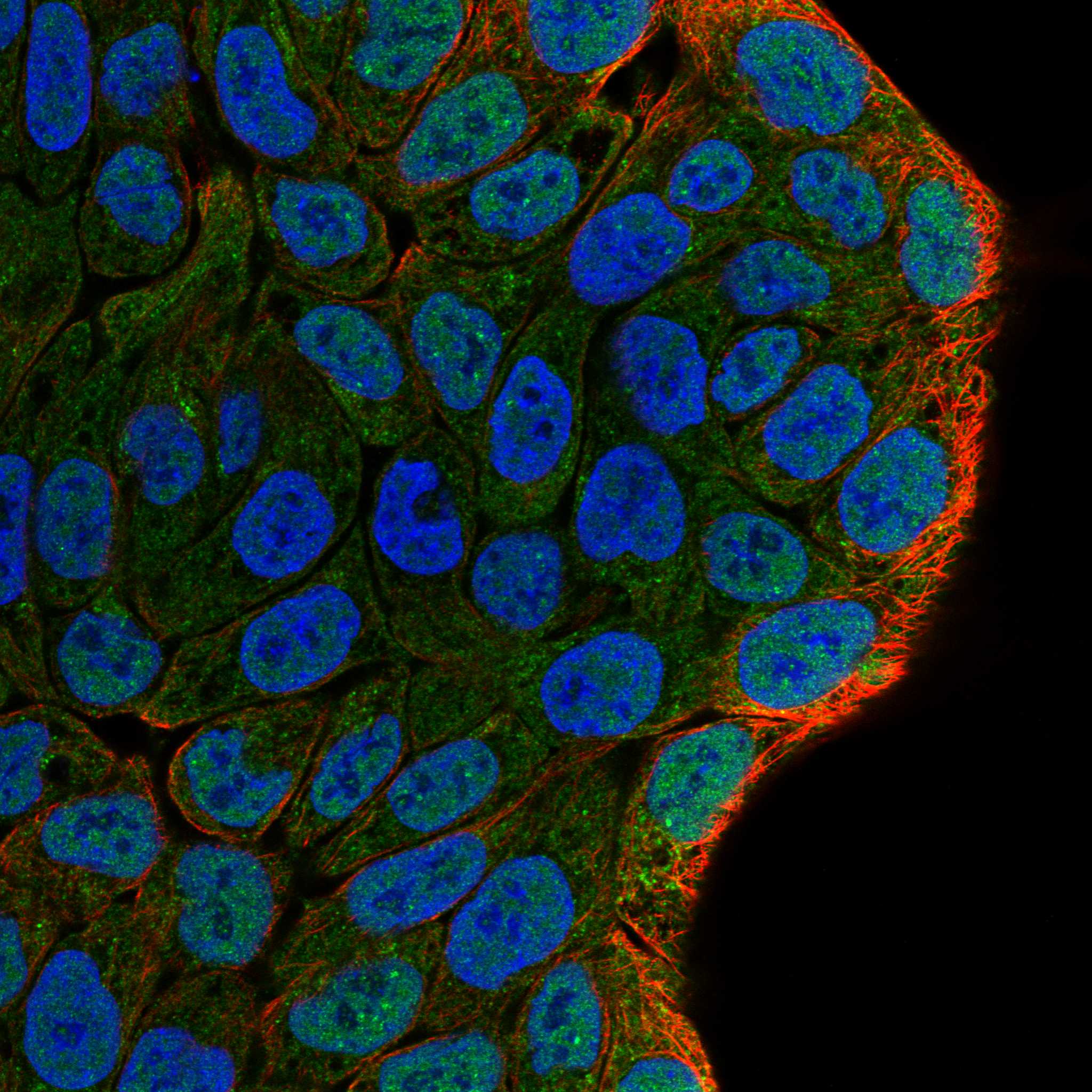 PARM1 fluorescence