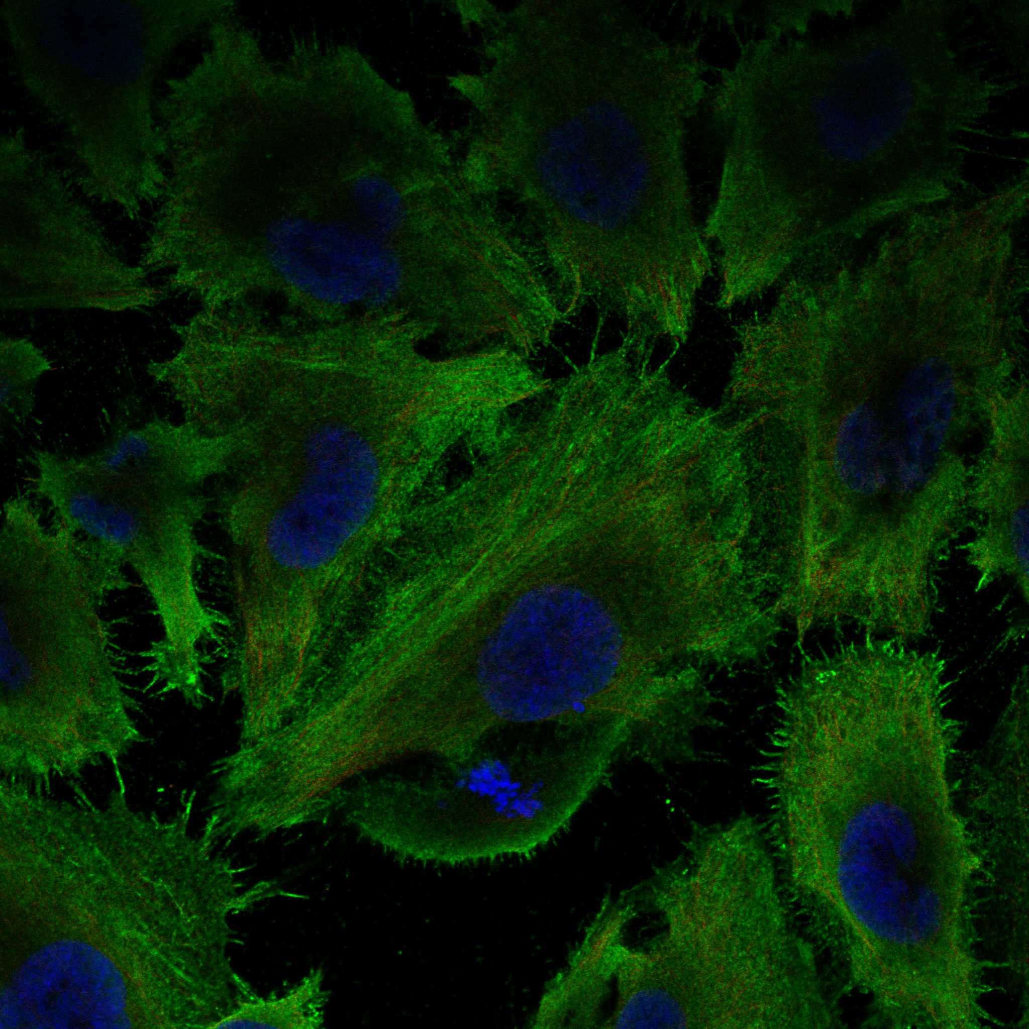 PARVB fluorescence