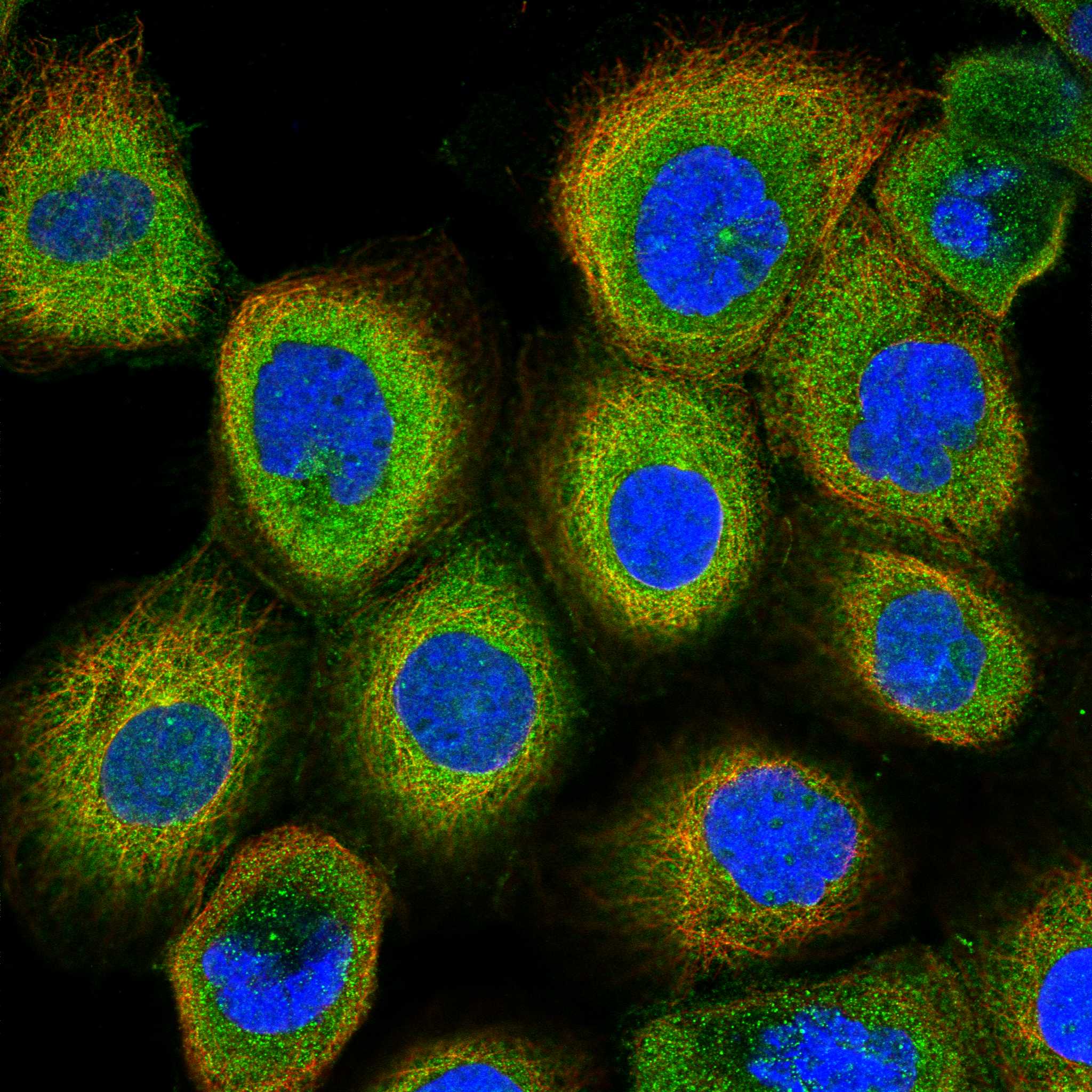 PIGN fluorescence