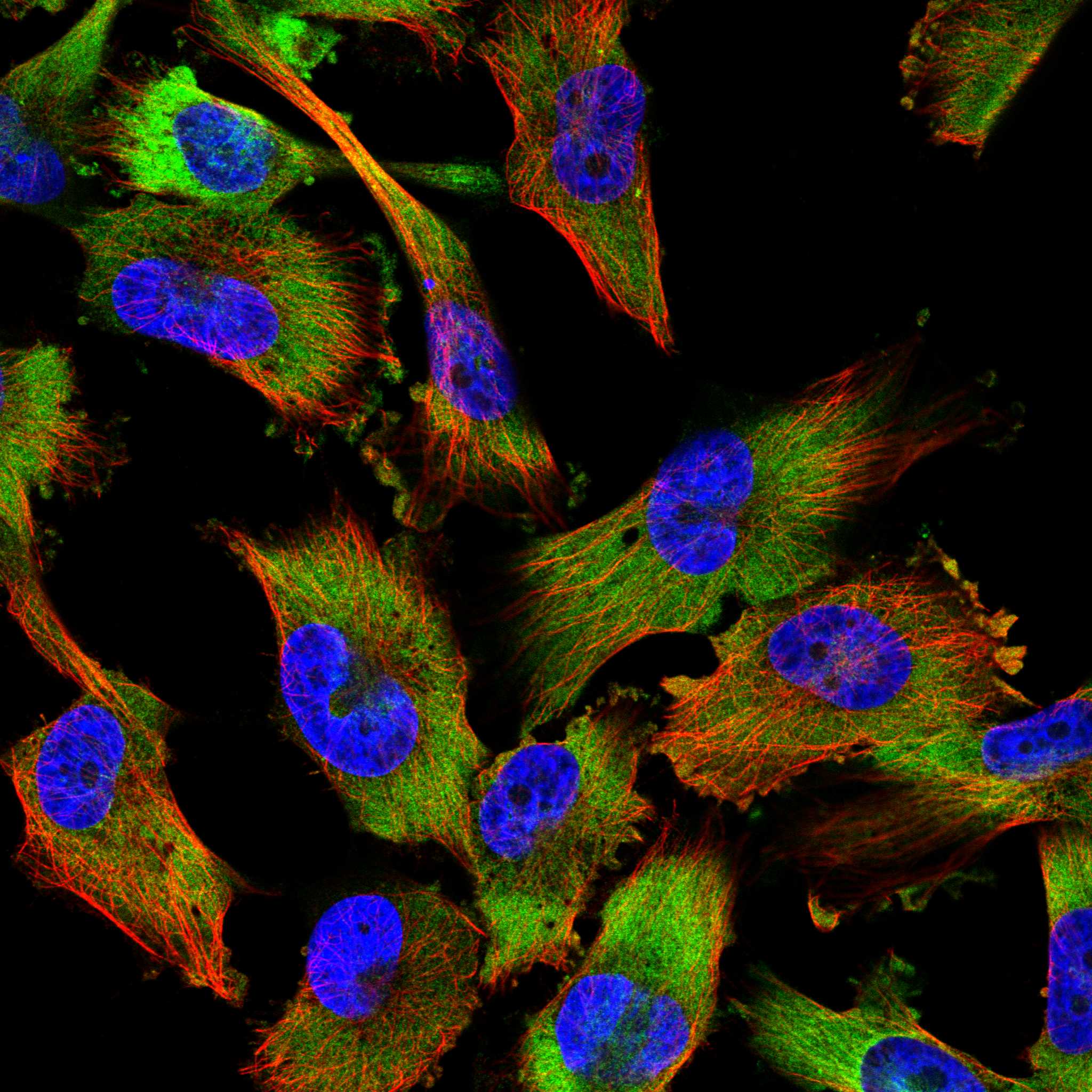 PKD2 fluorescence