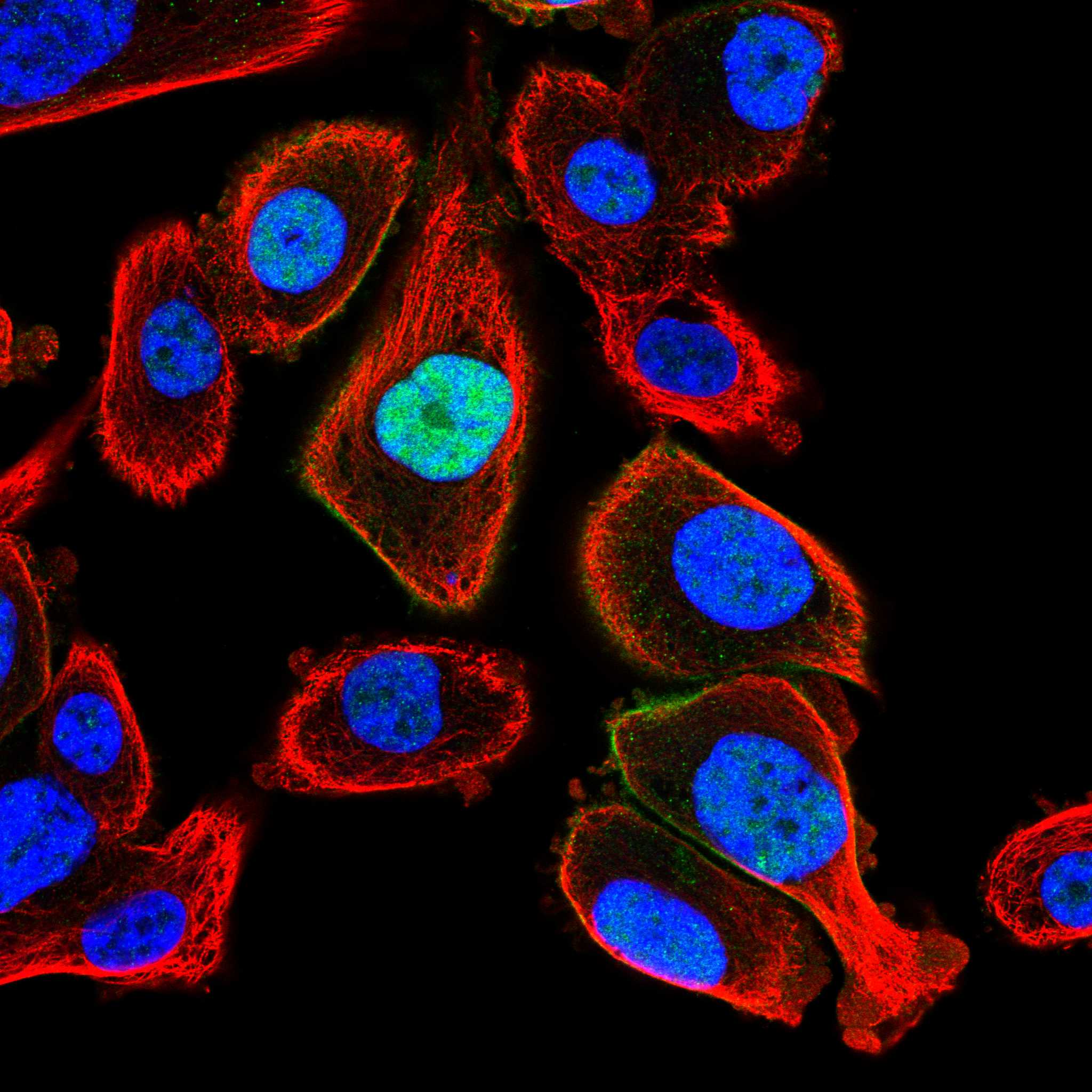 PKP1 fluorescence