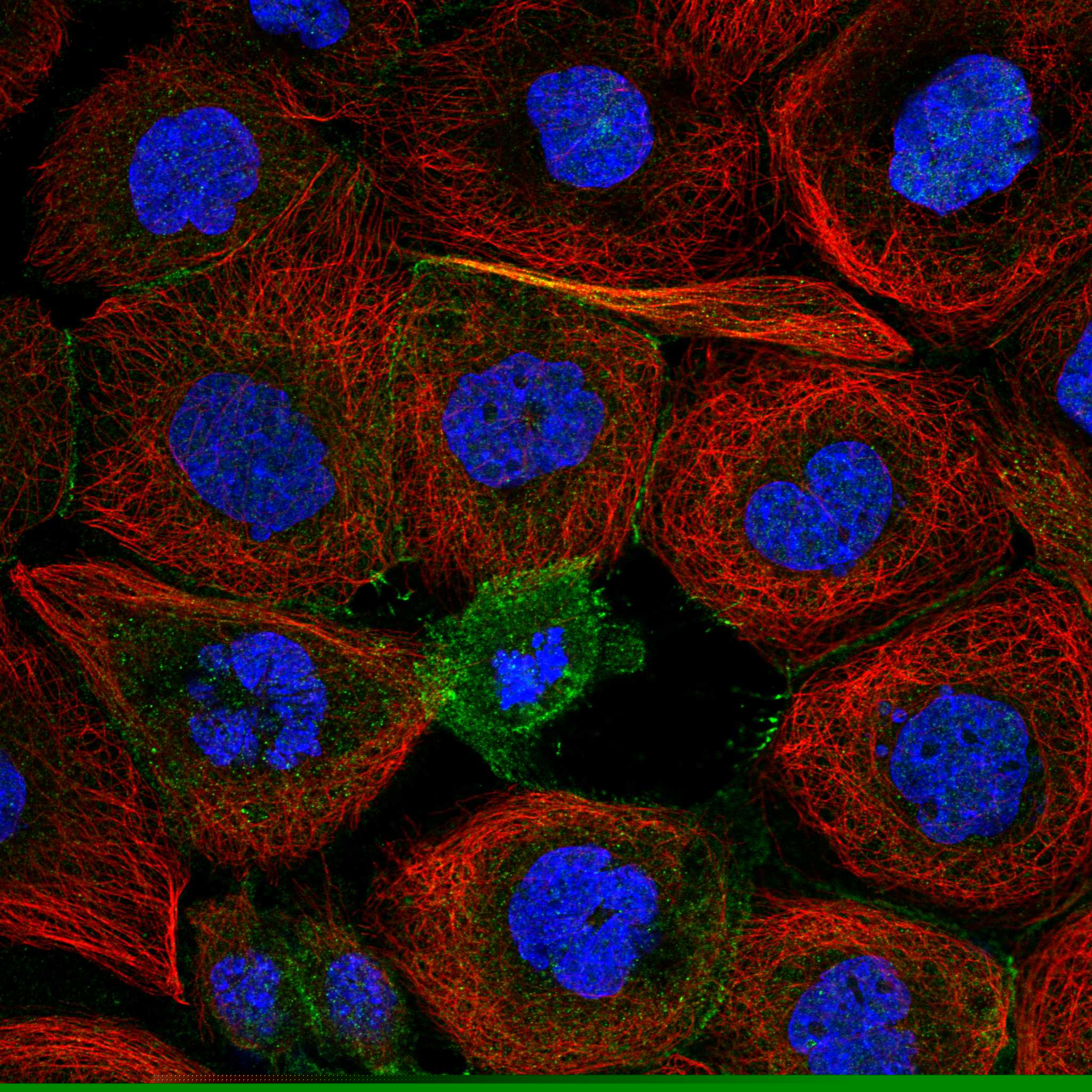 PLCB1 fluorescence