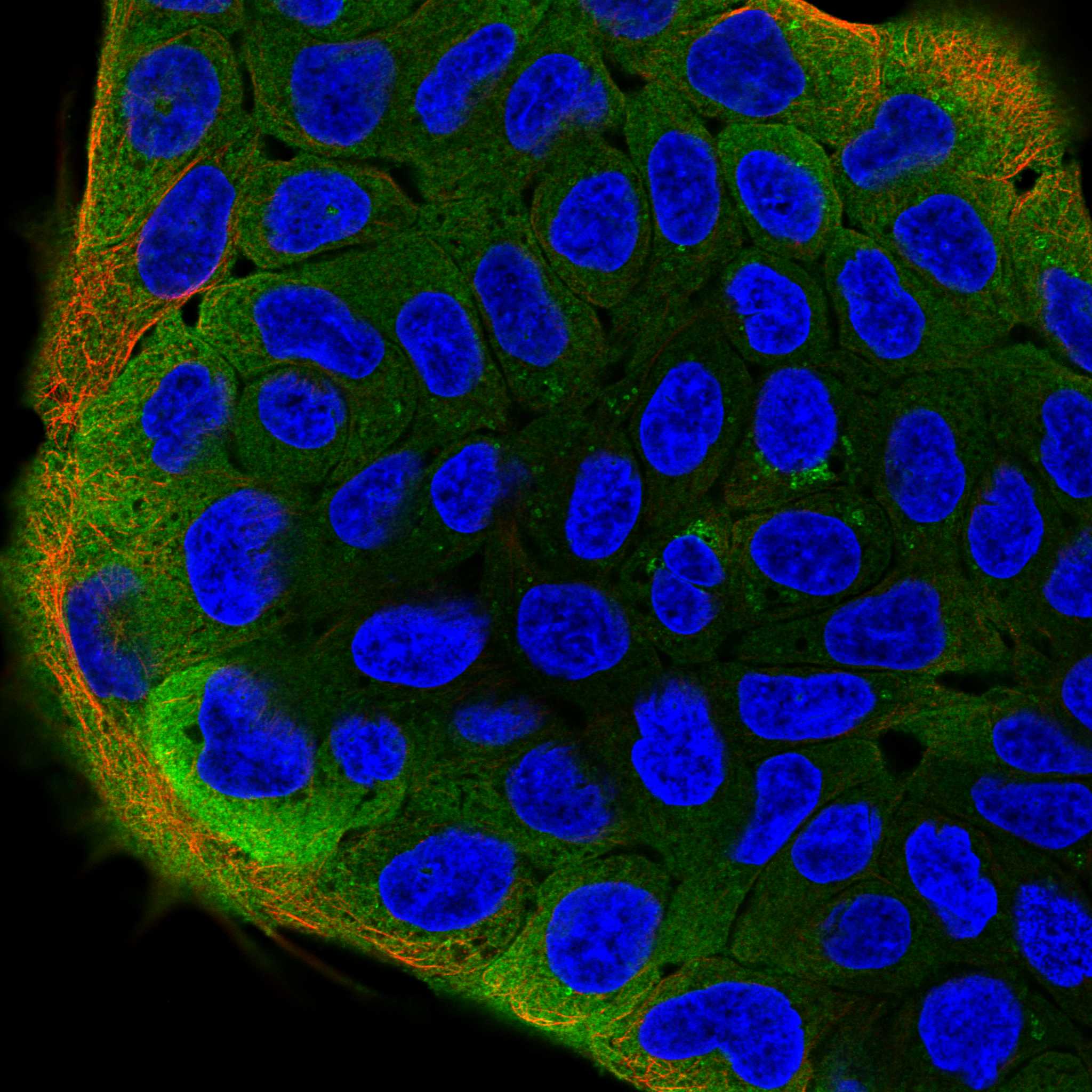 PLIN4 fluorescence