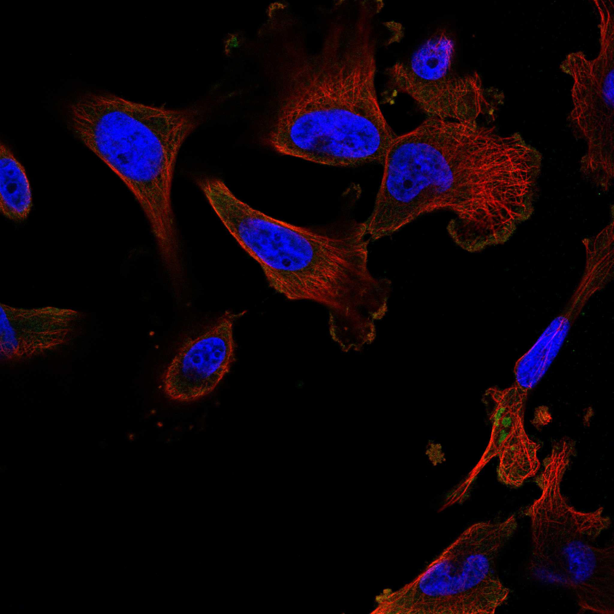 PLPP1 fluorescence