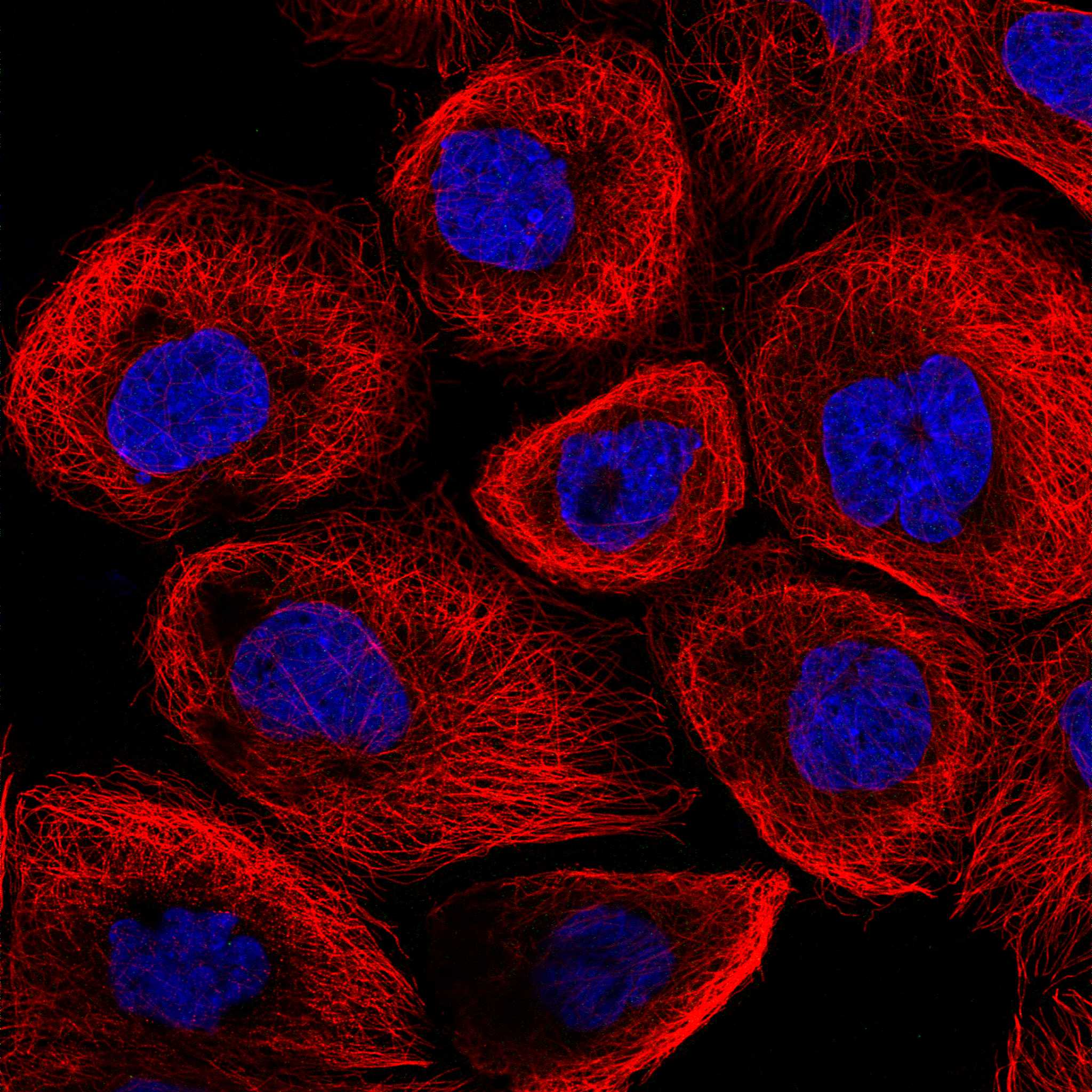 PPAT fluorescence