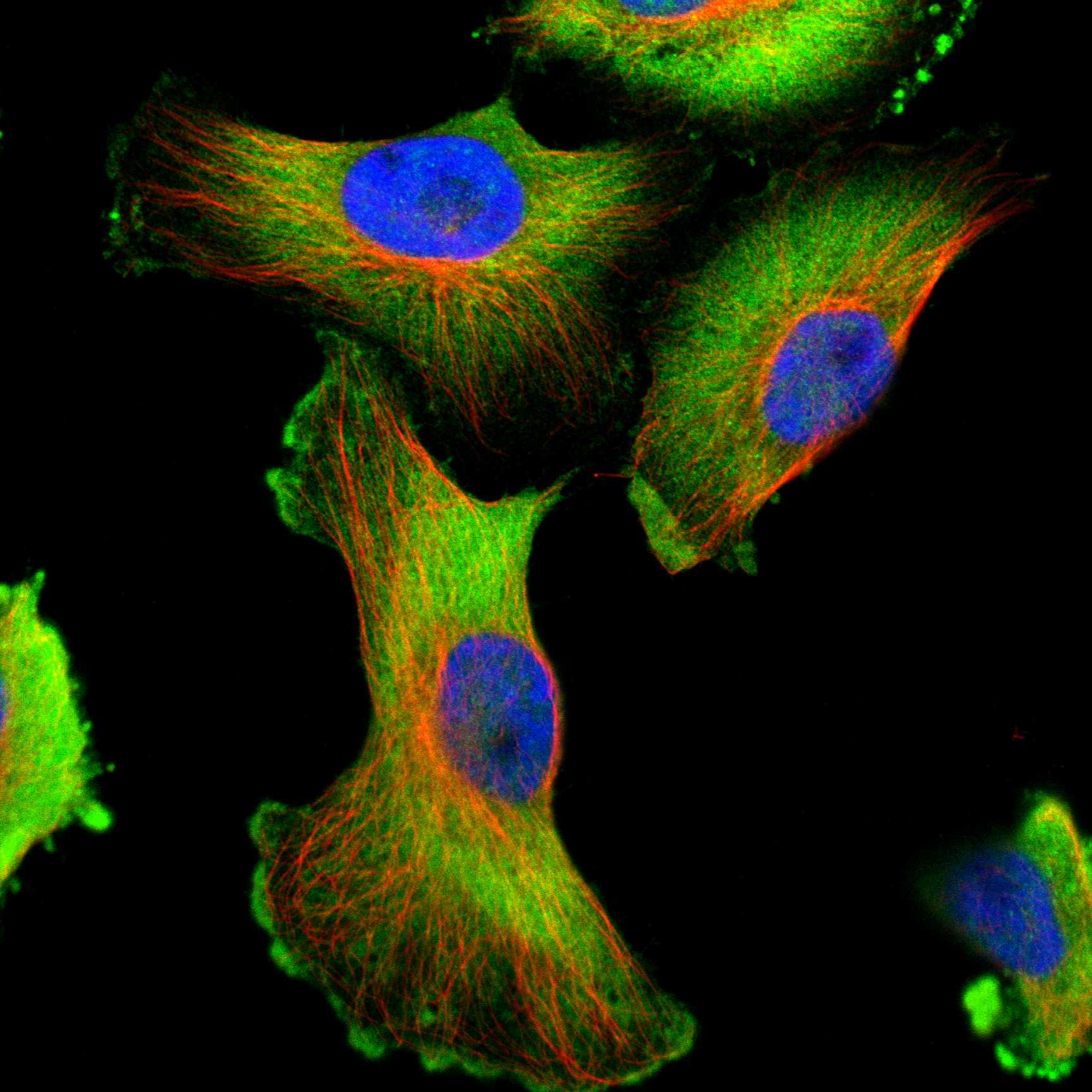 PYGL fluorescence