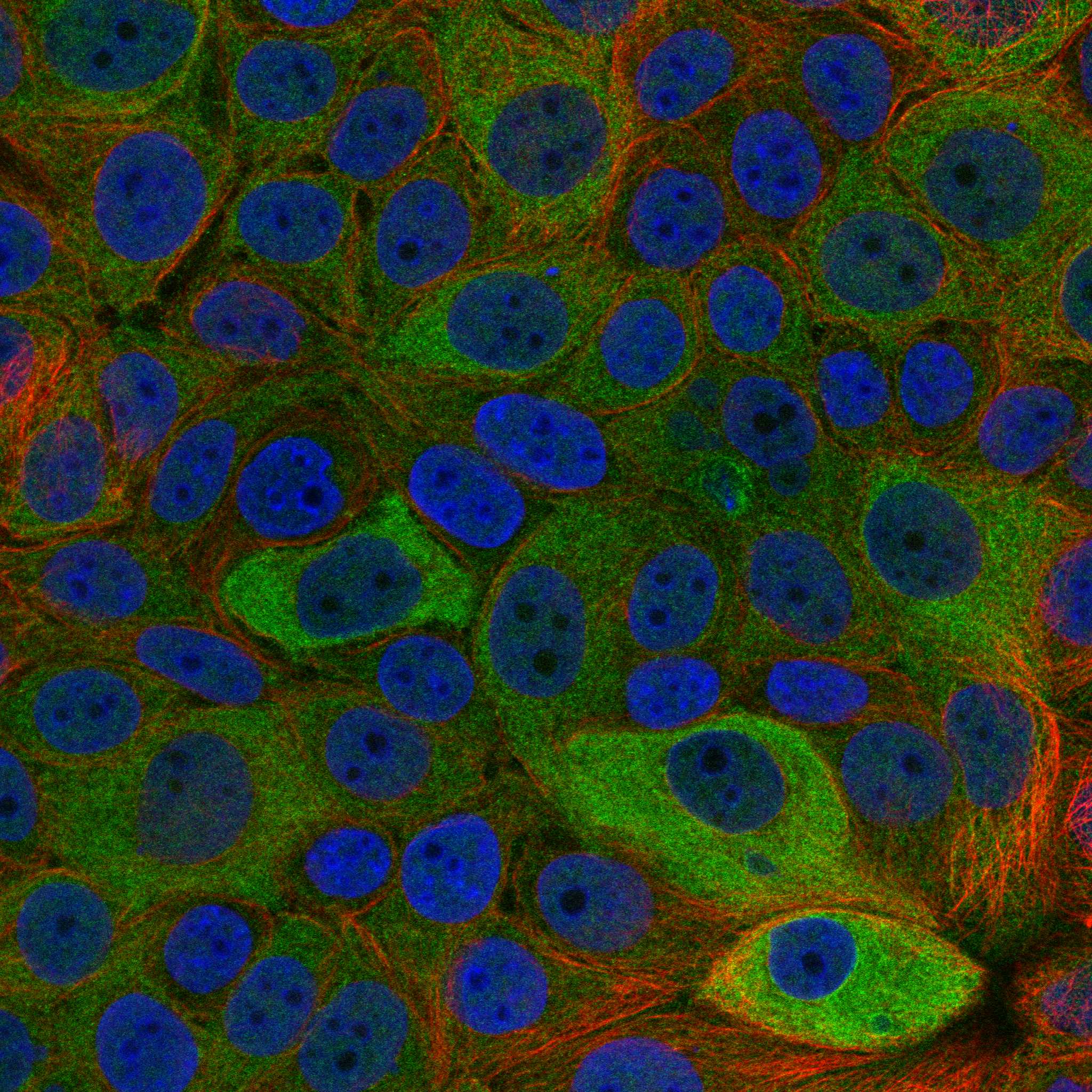 RAB25 fluorescence