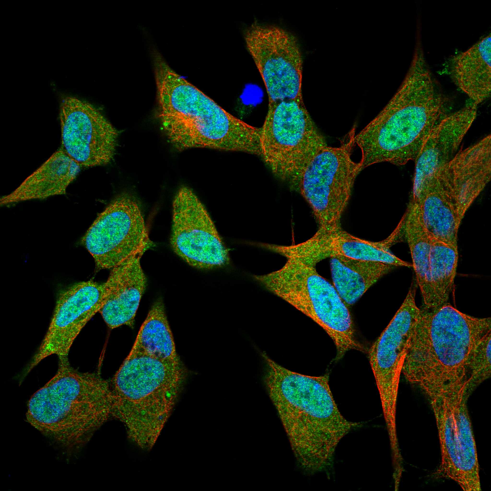 RBP1 fluorescence