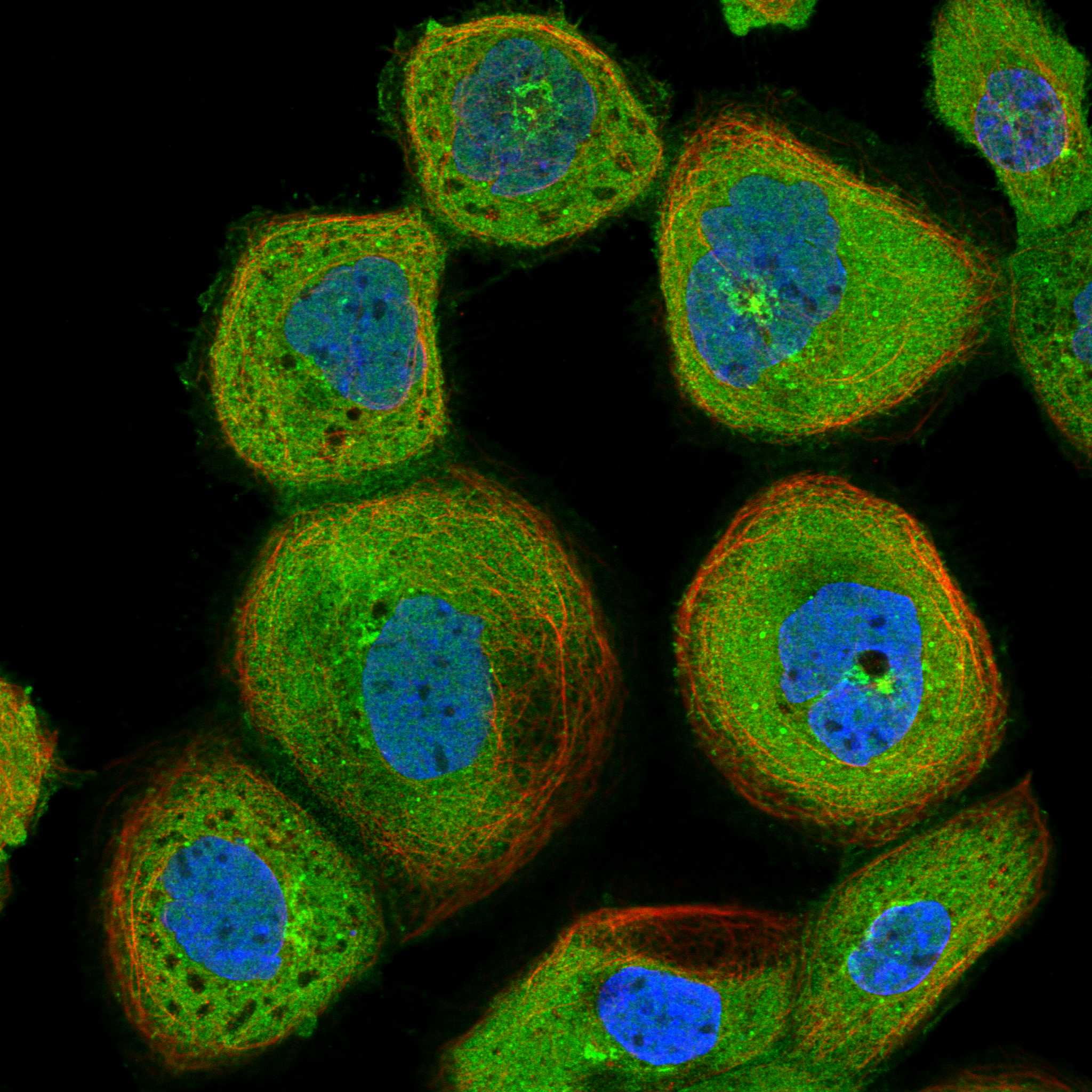 RIOK3 fluorescence