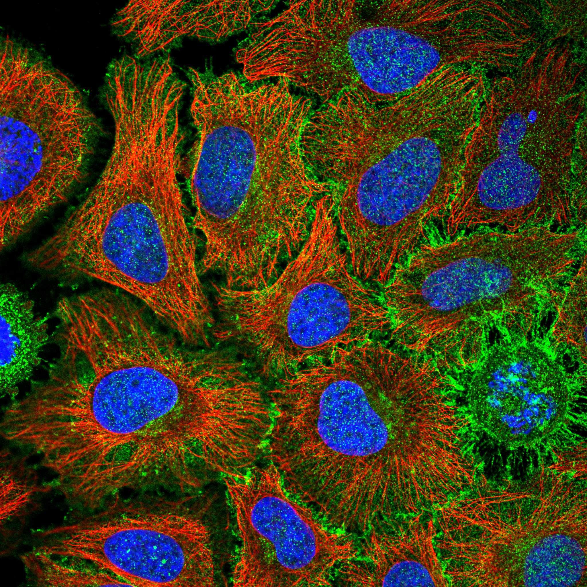 ROBO1 fluorescence