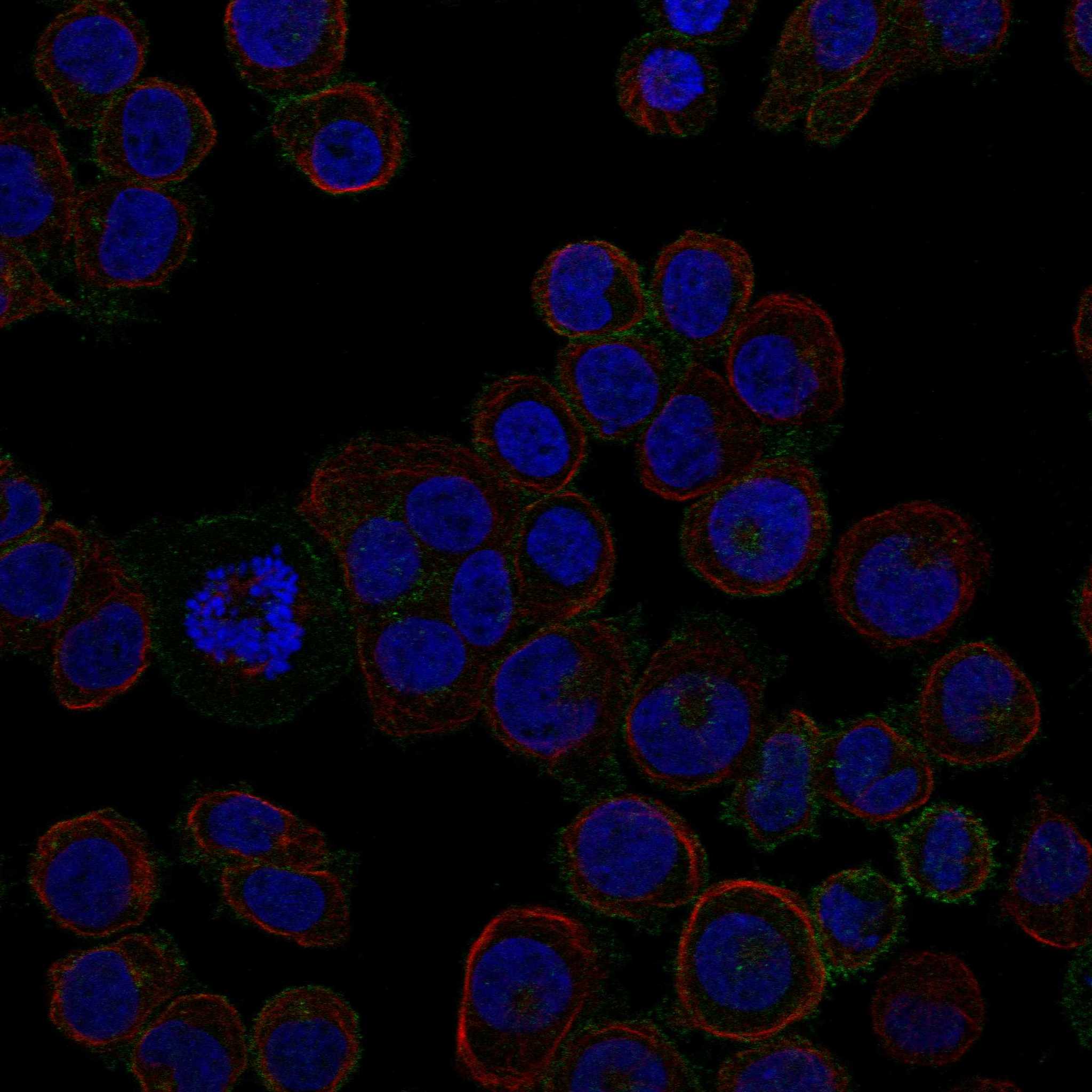 ROBO2 fluorescence
