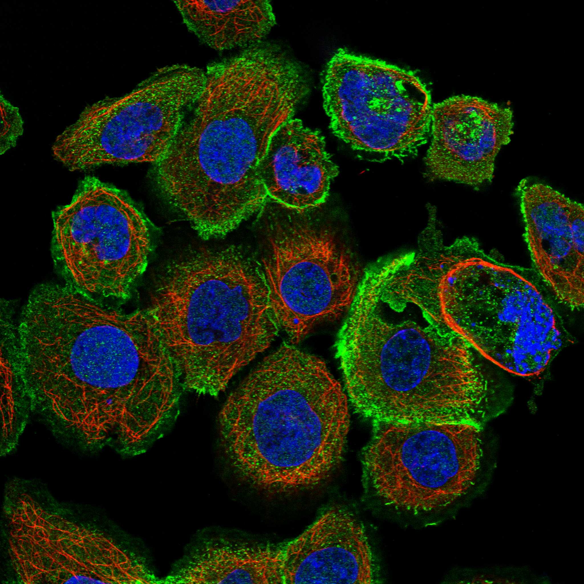 ROM1 fluorescence