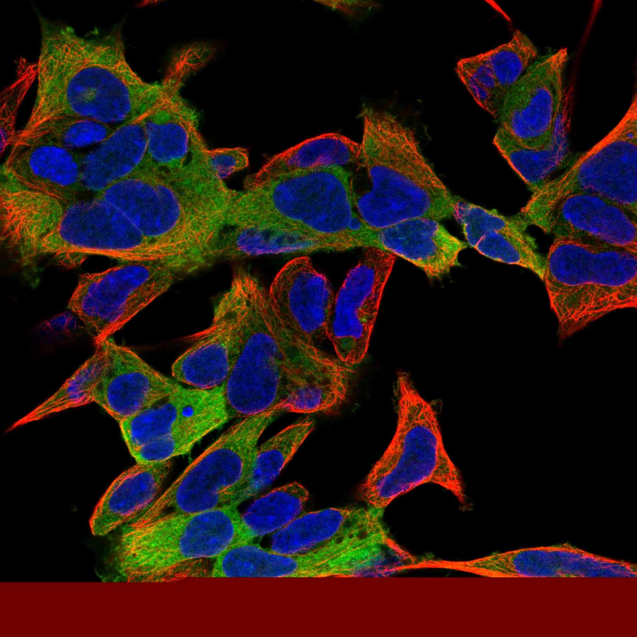 SCIN fluorescence