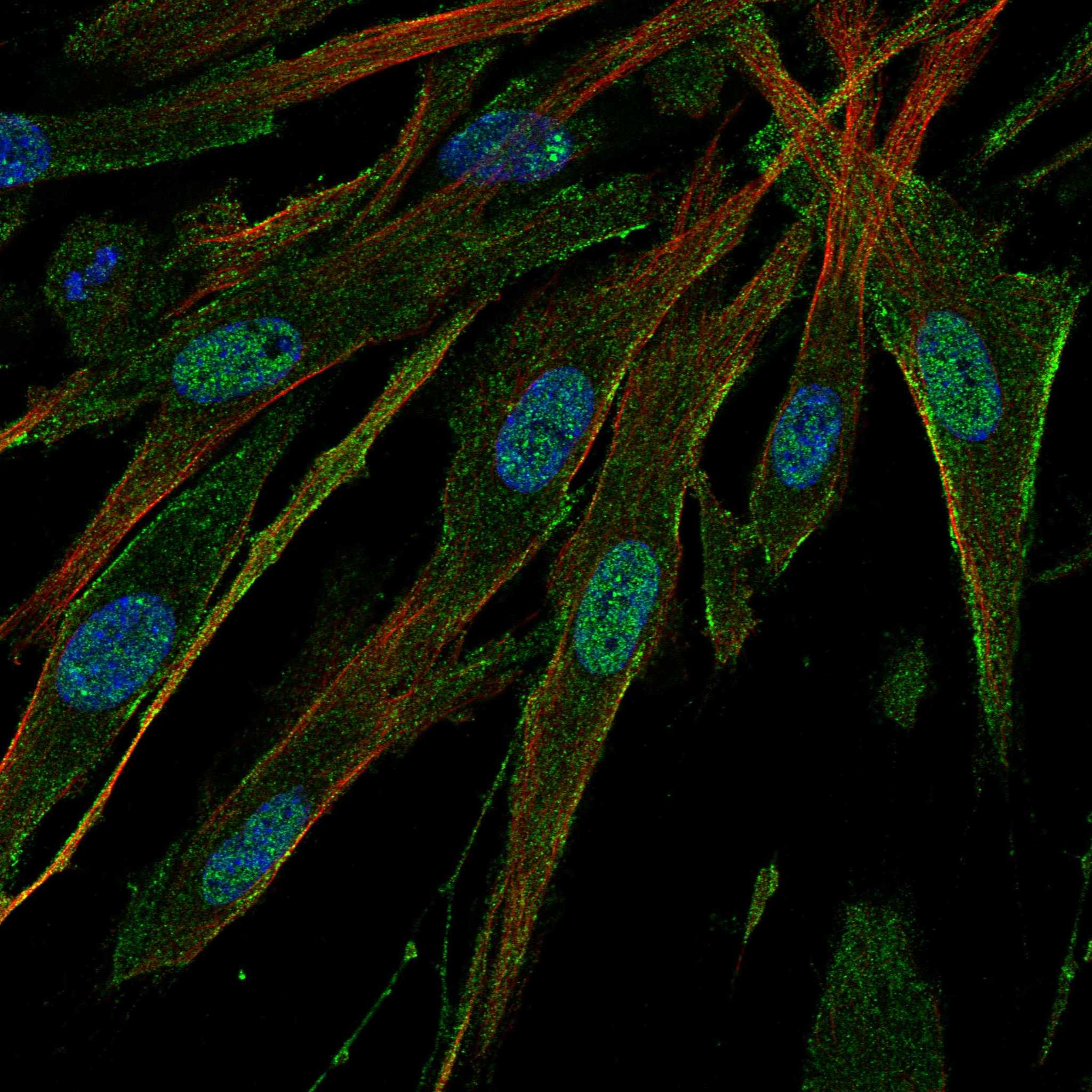 SCN1A fluorescence
