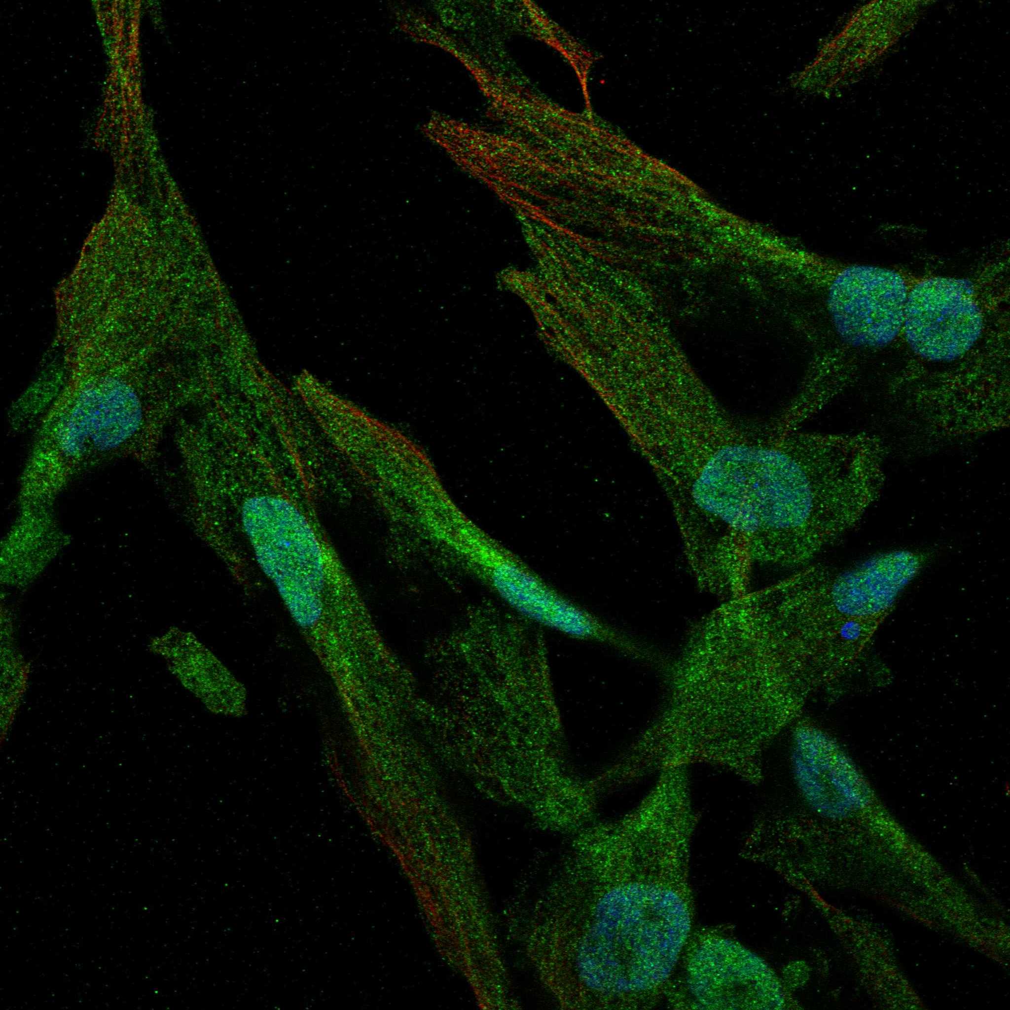 SCN5A fluorescence