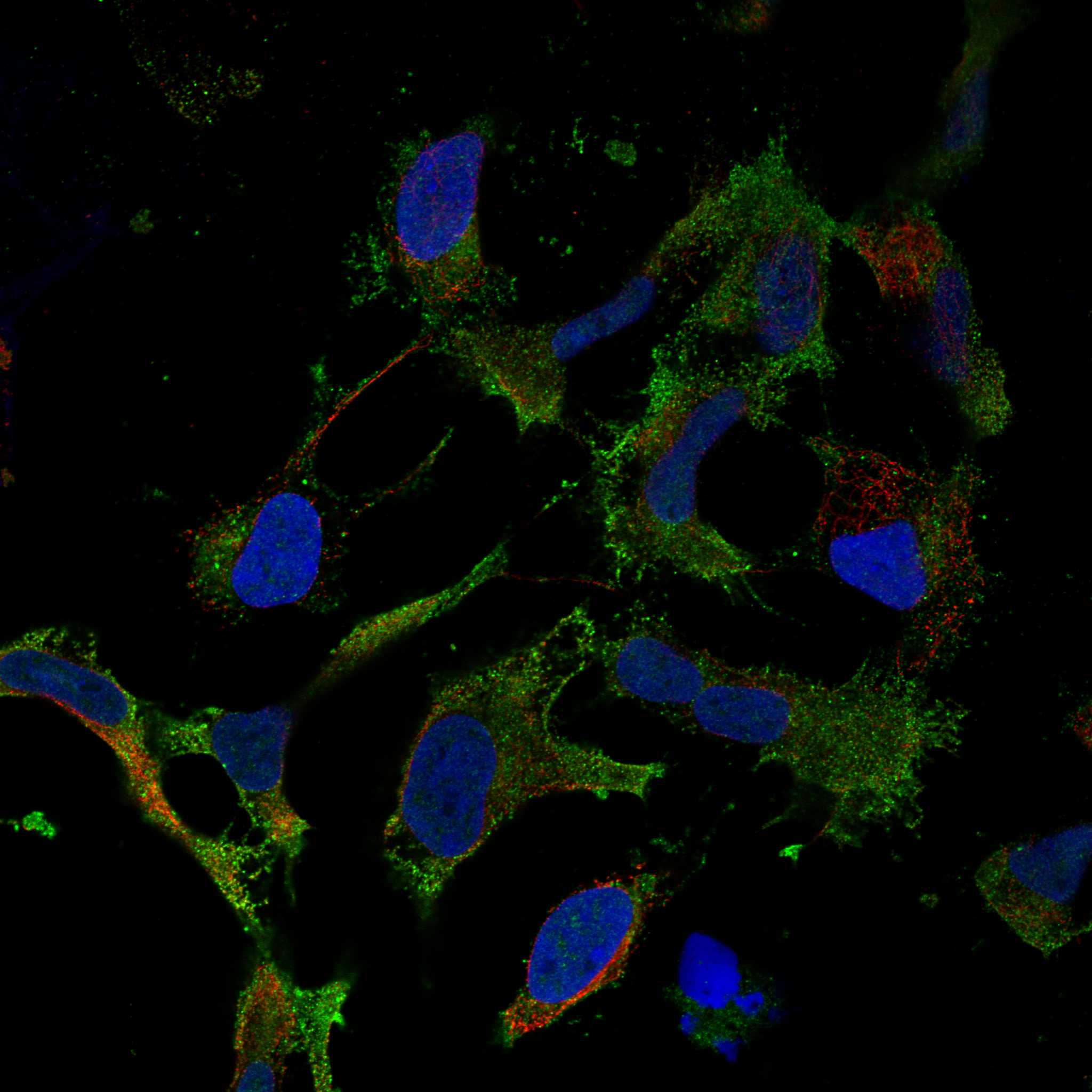 SCN8A fluorescence