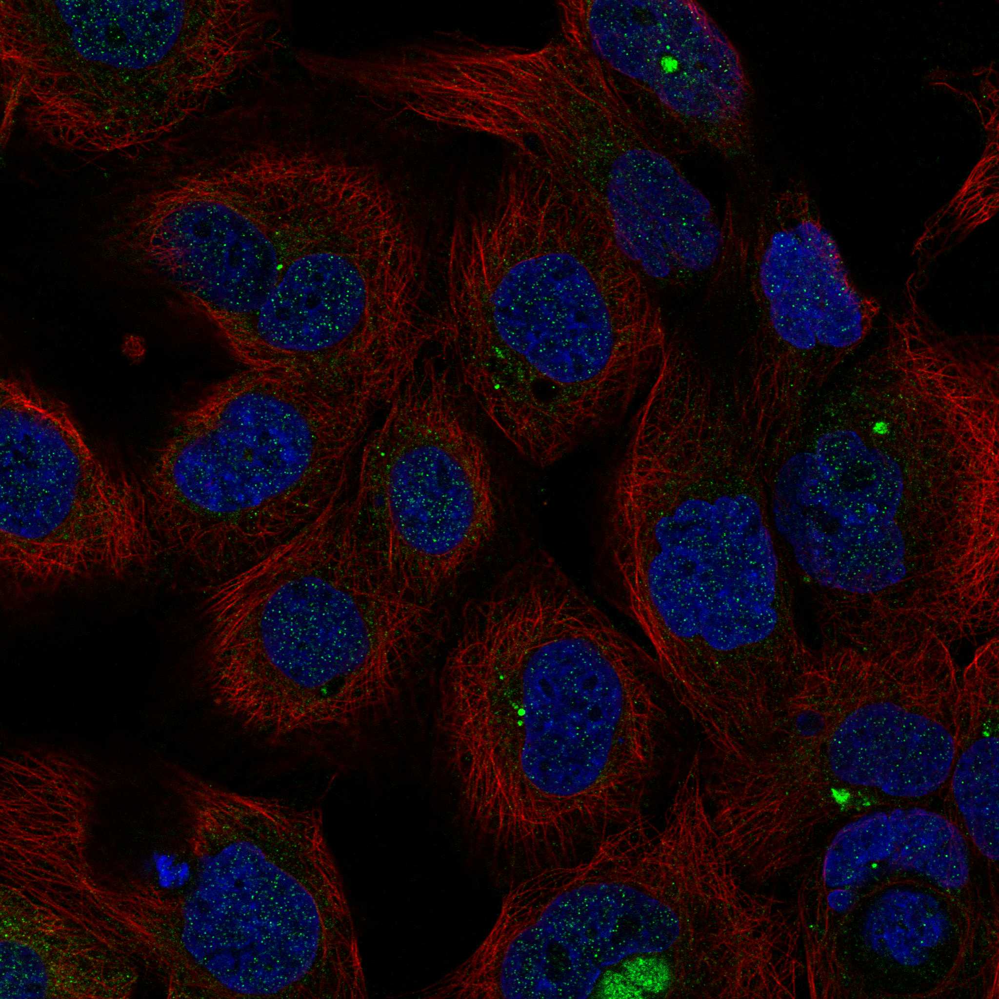 SGCB fluorescence