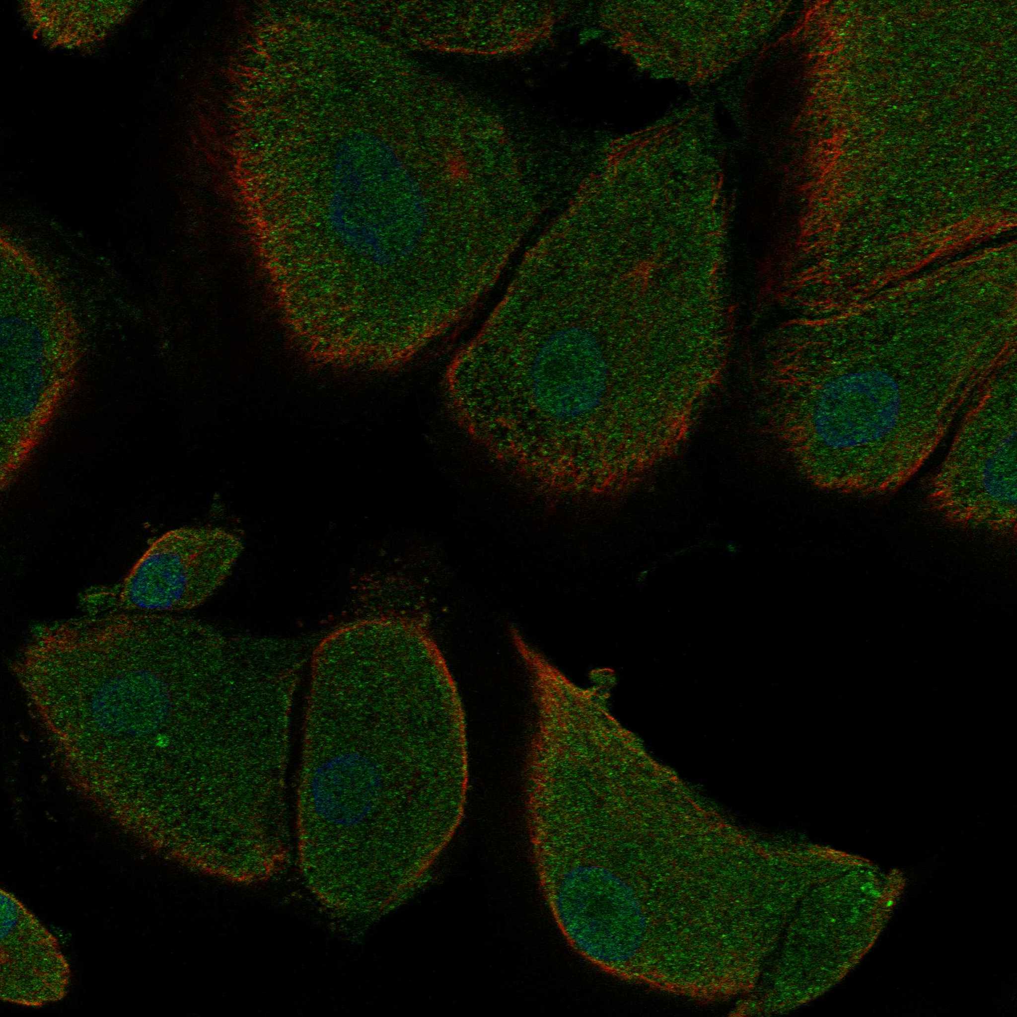 SKAP1 fluorescence