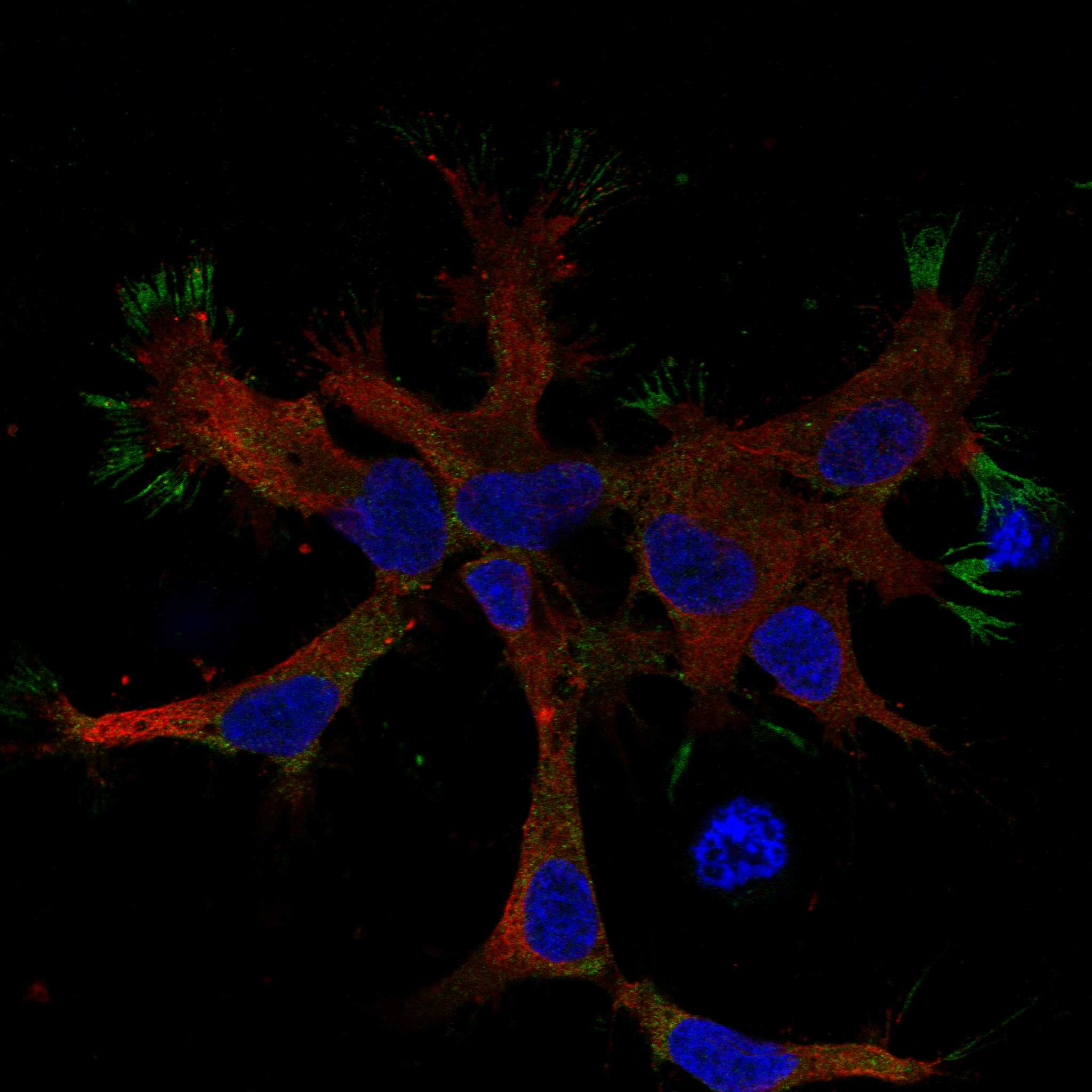 SLIT1 fluorescence