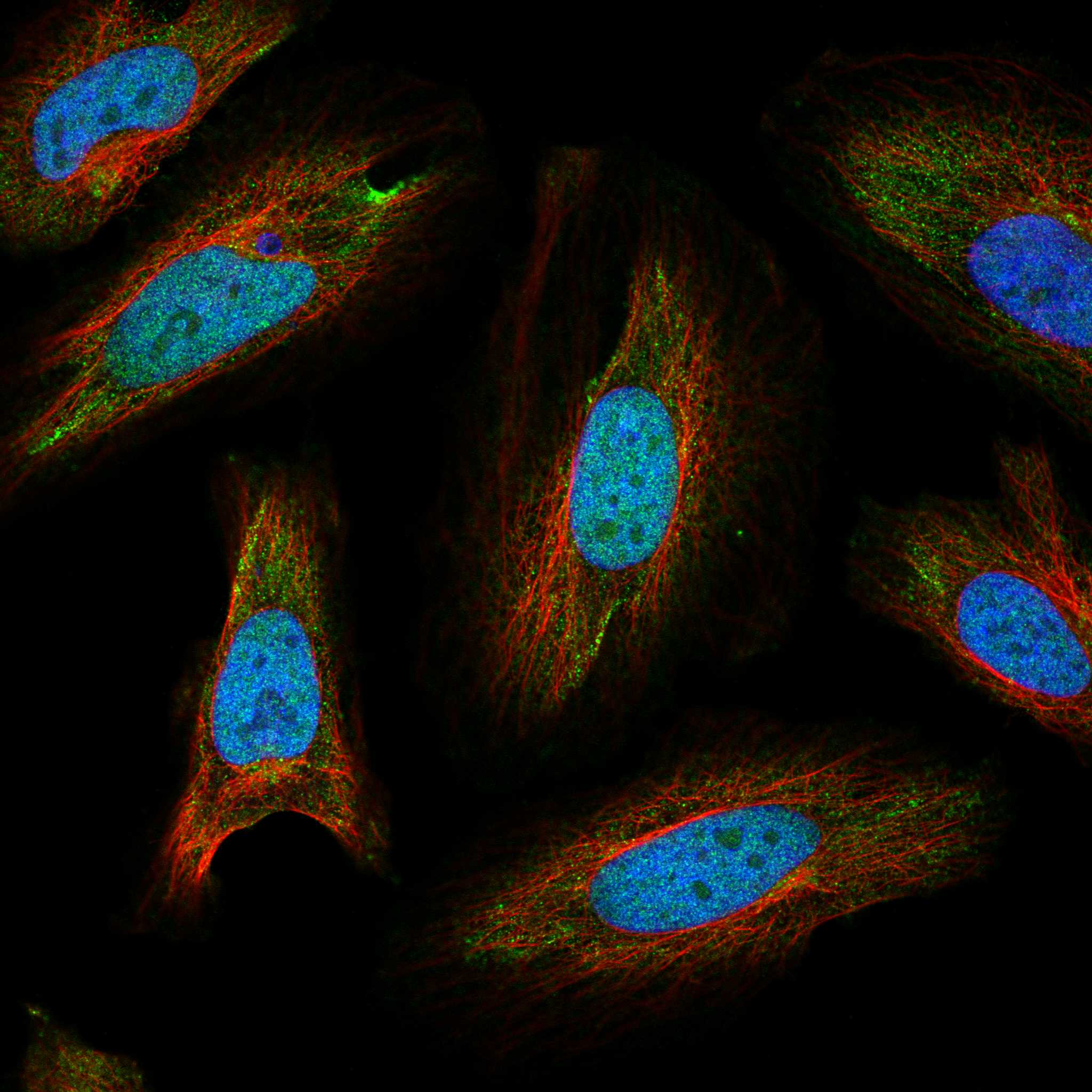SMOC1 fluorescence