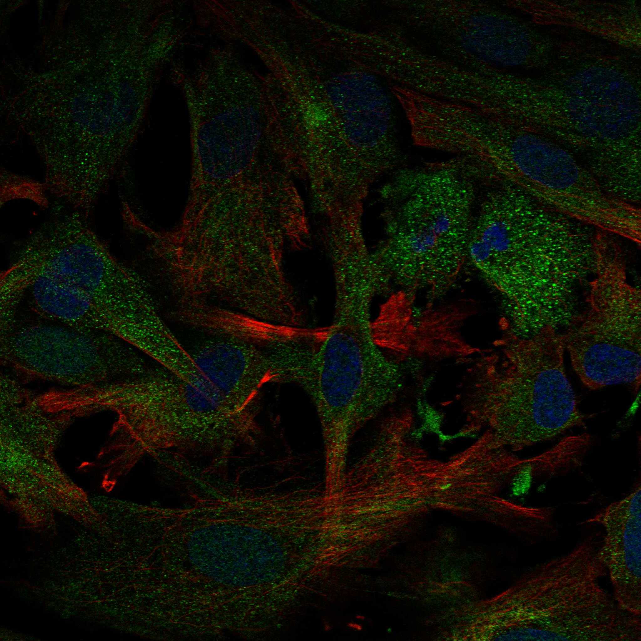 SNX16 fluorescence