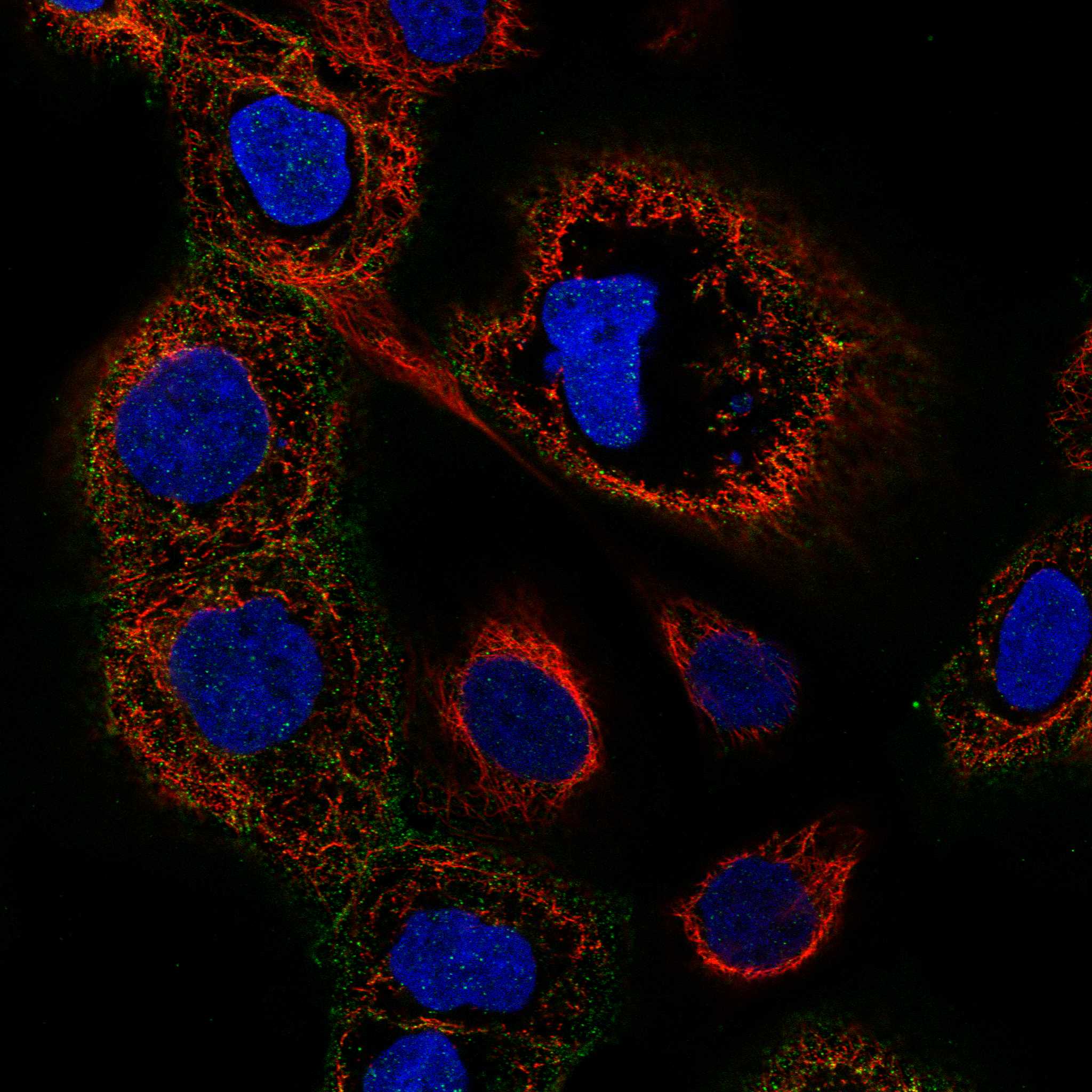 SPHK1 fluorescence