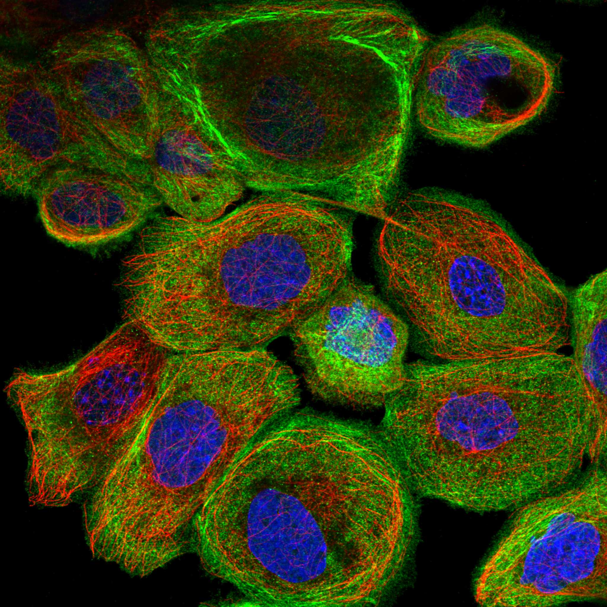 SVIL fluorescence