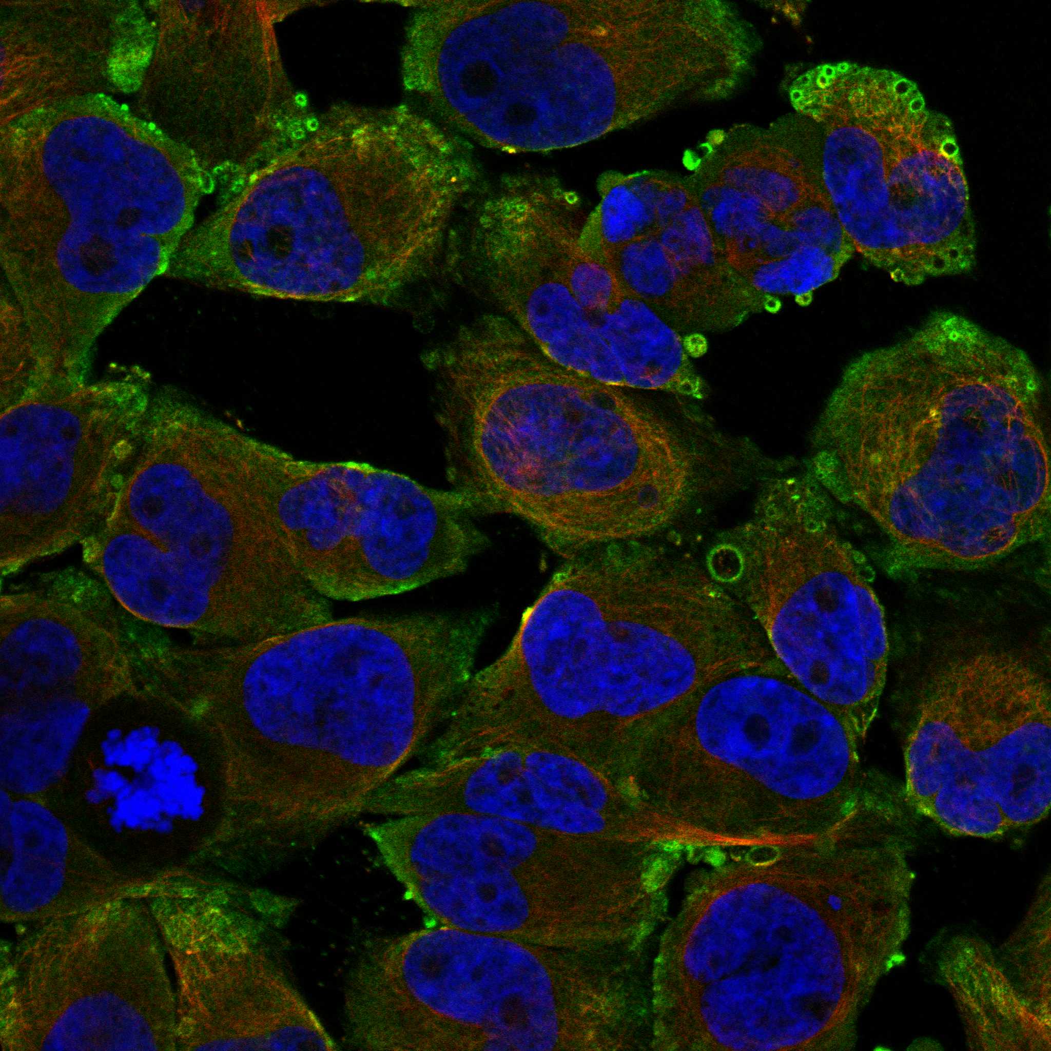 TAOK1 fluorescence