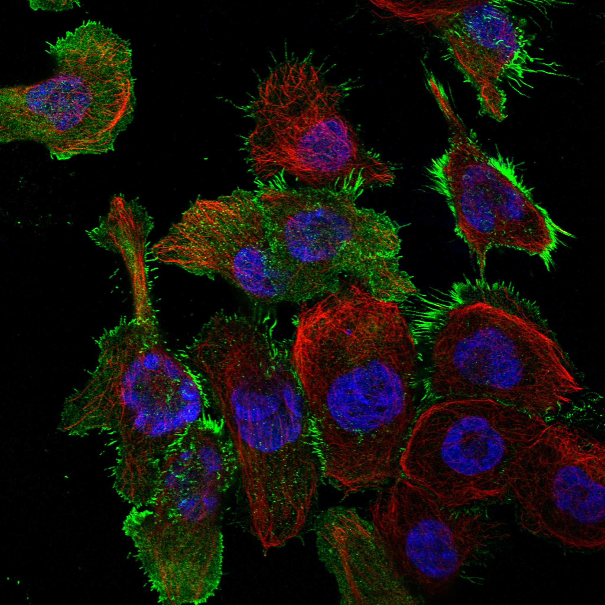 TASP1 fluorescence