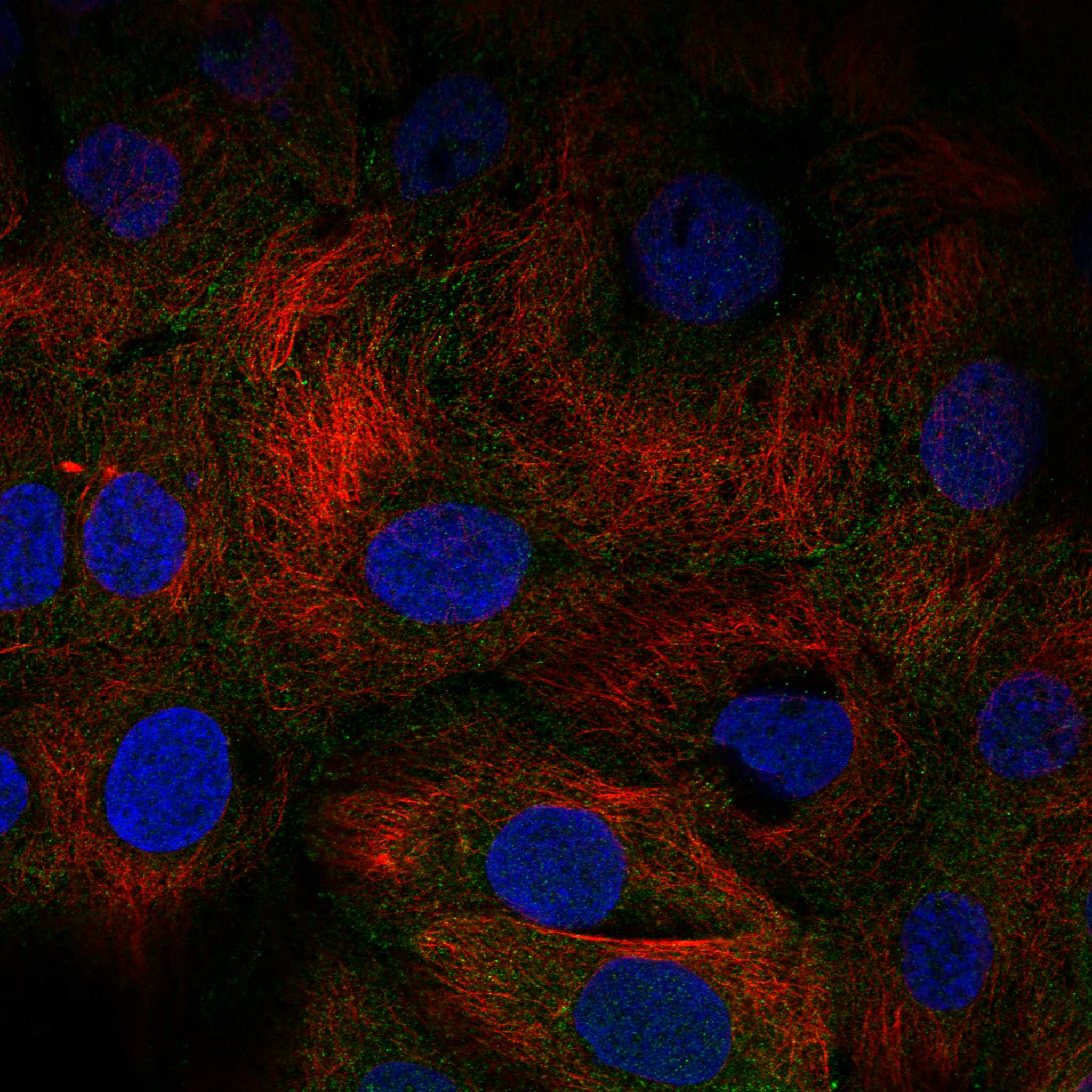TGM1 fluorescence