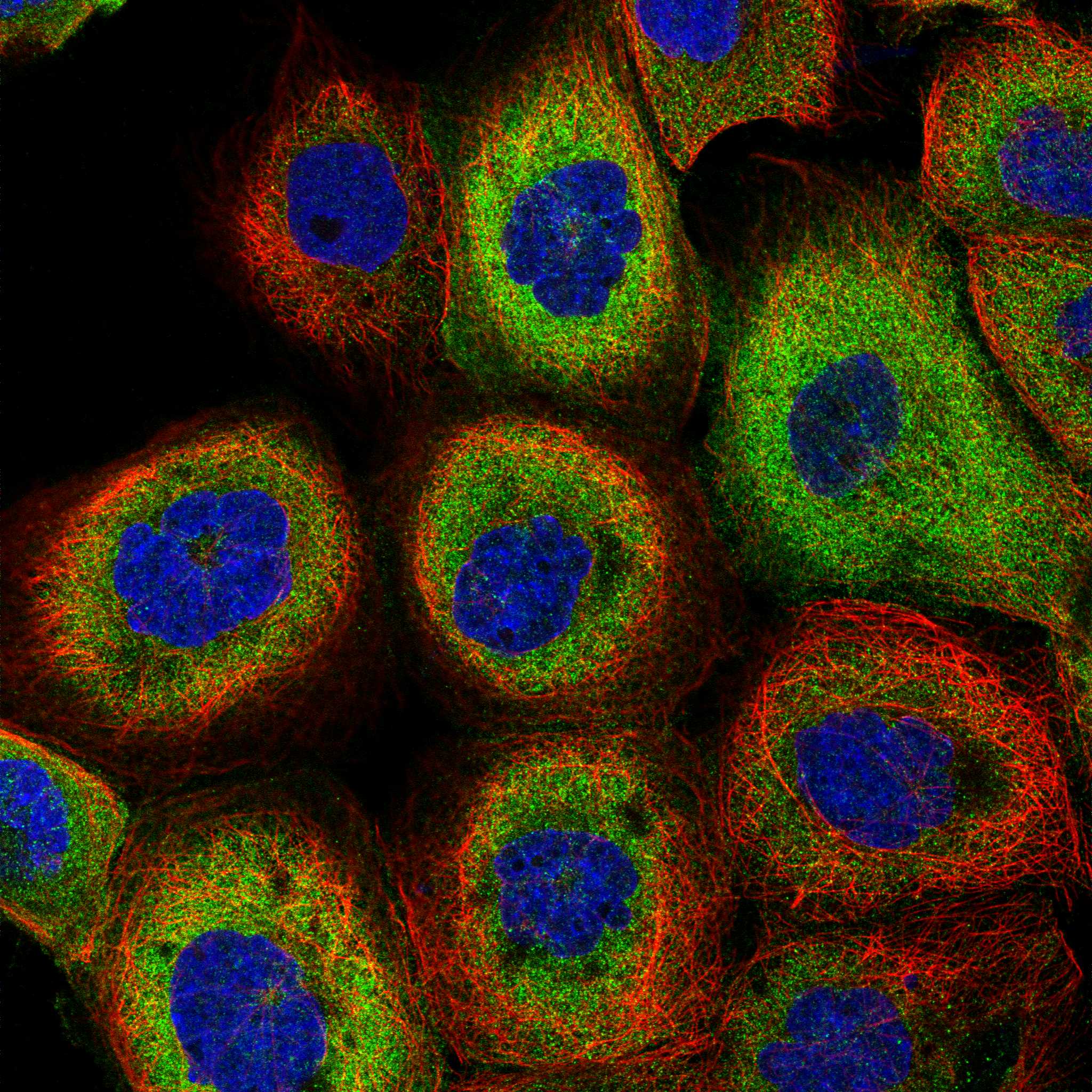 TGM2 fluorescence