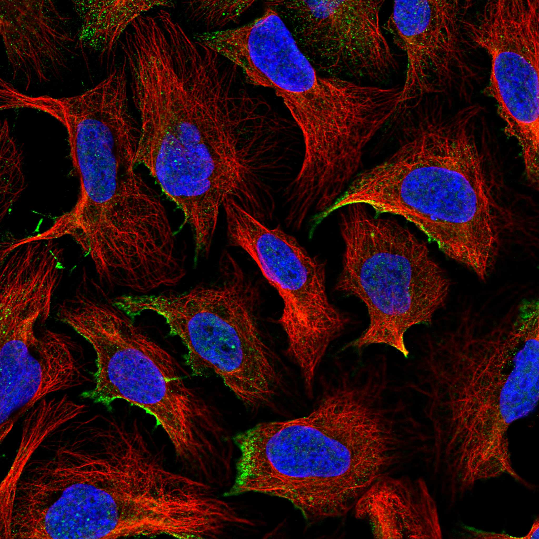 TM2D2 fluorescence