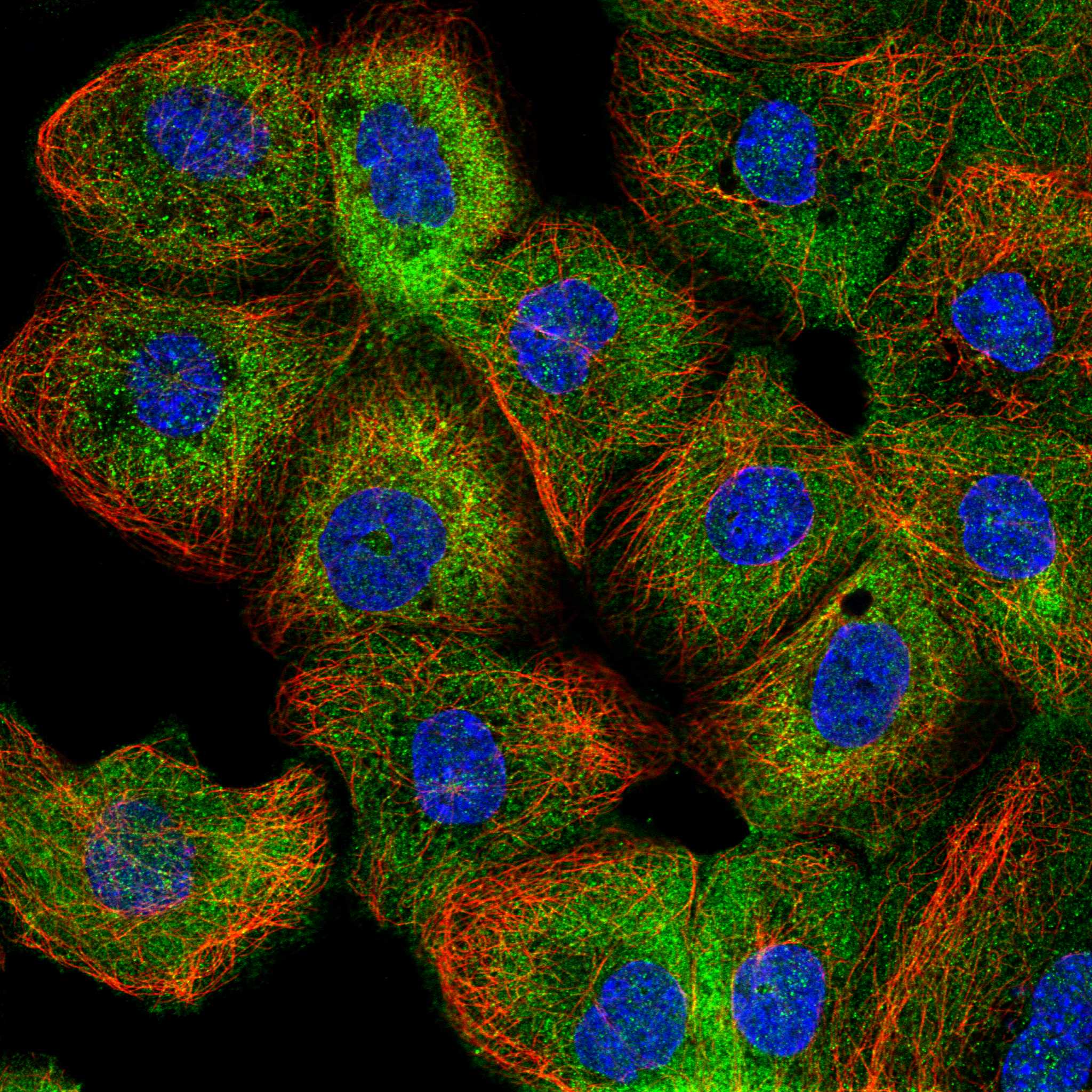 TMTC2 fluorescence