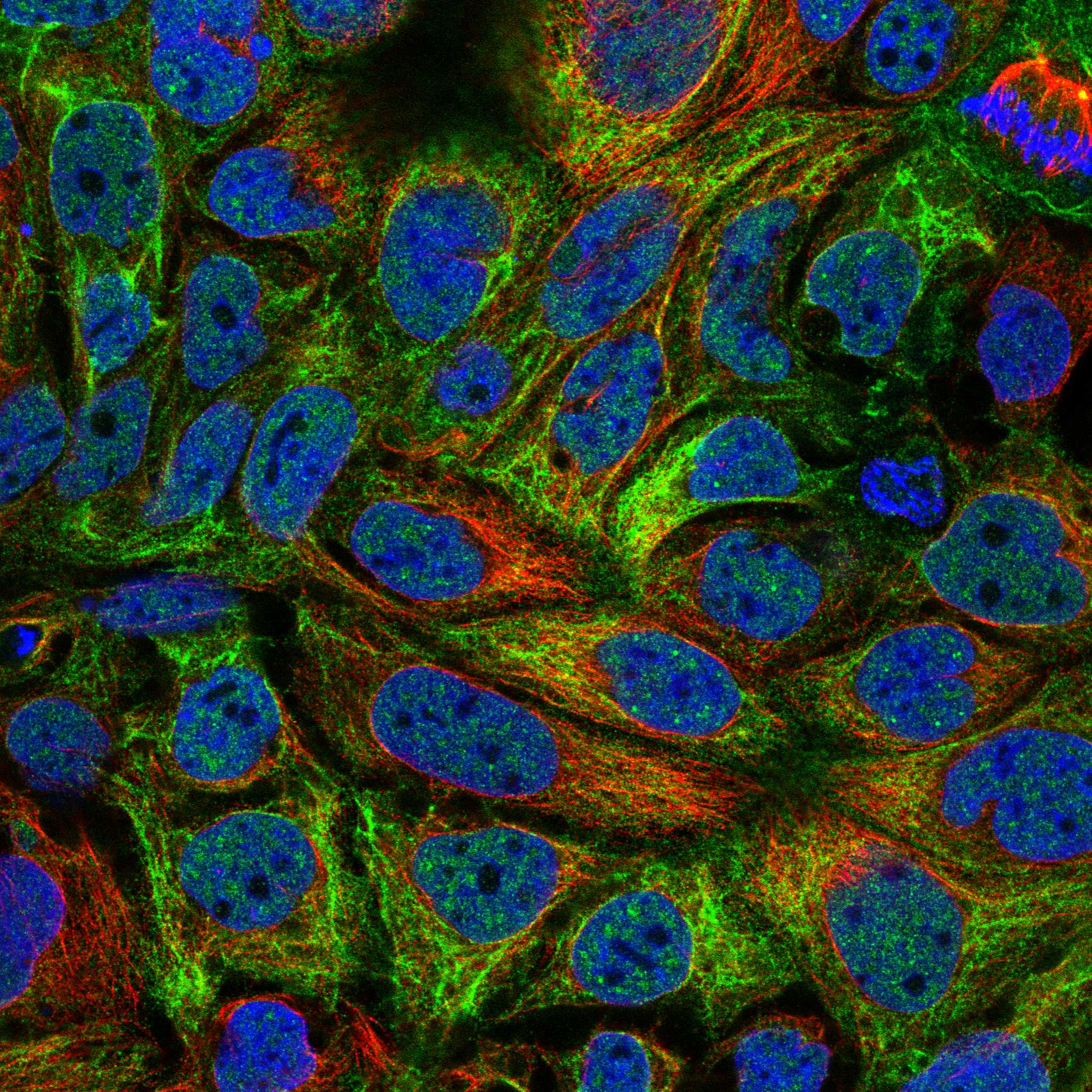 TNNI2 fluorescence