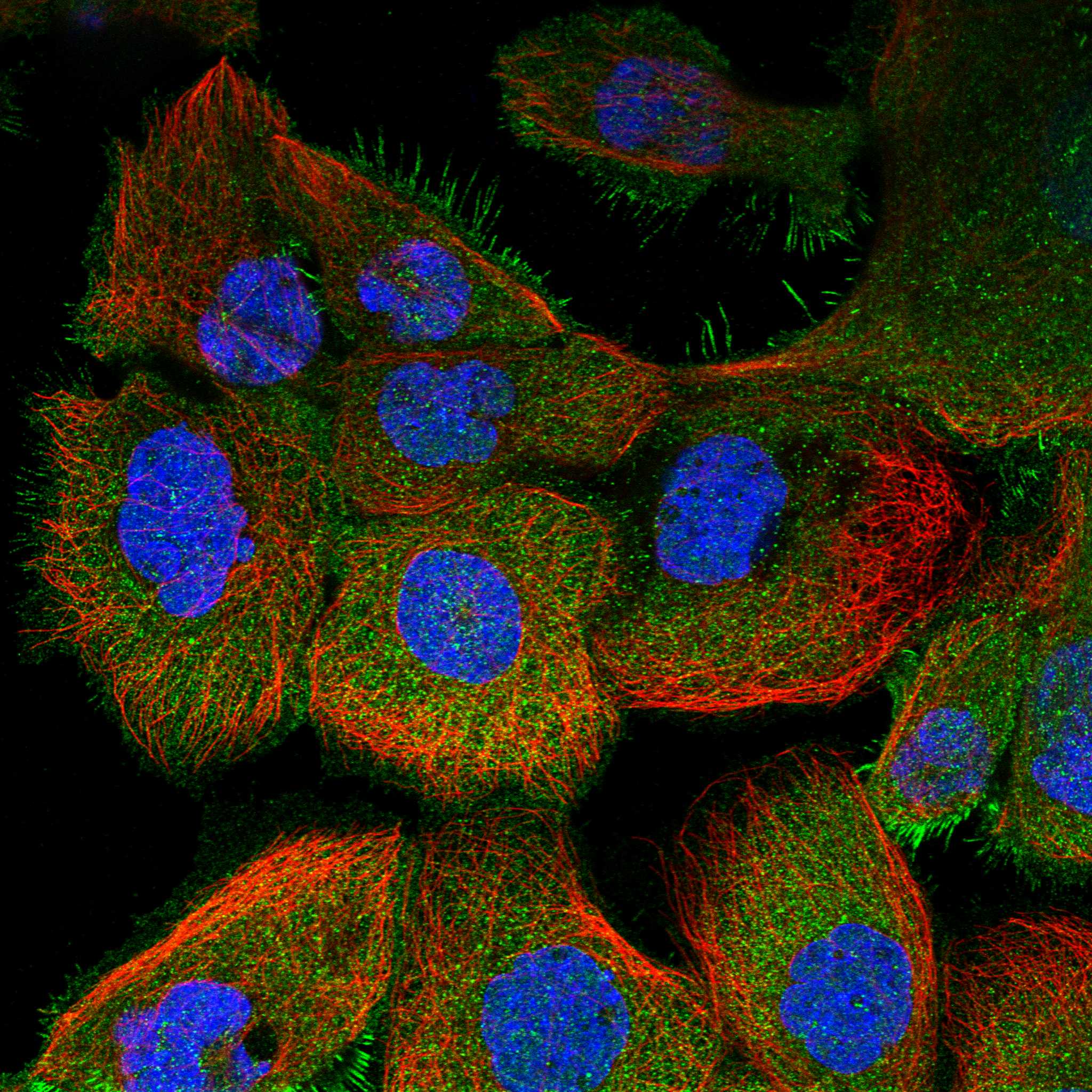 TRAIP fluorescence