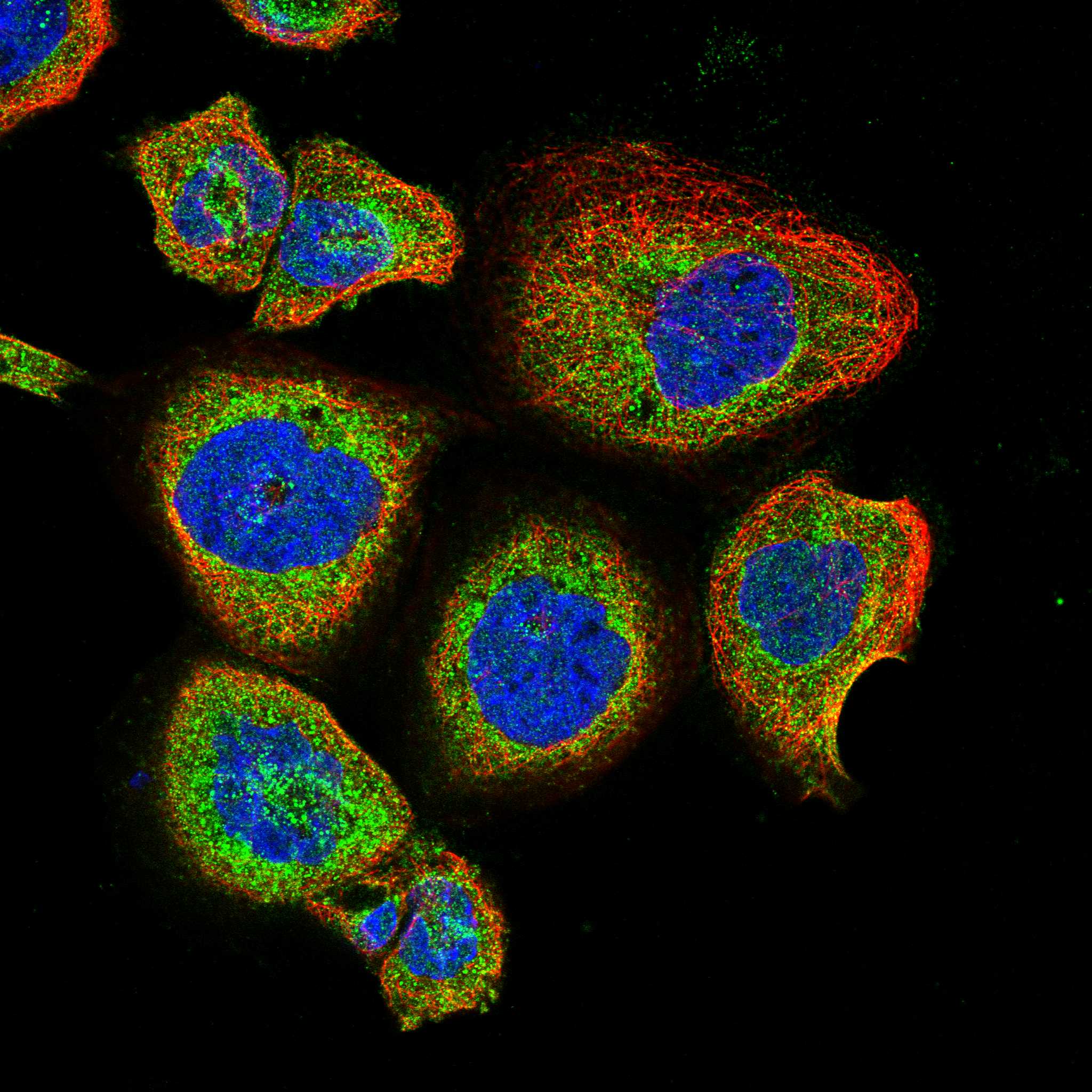 TRDN fluorescence