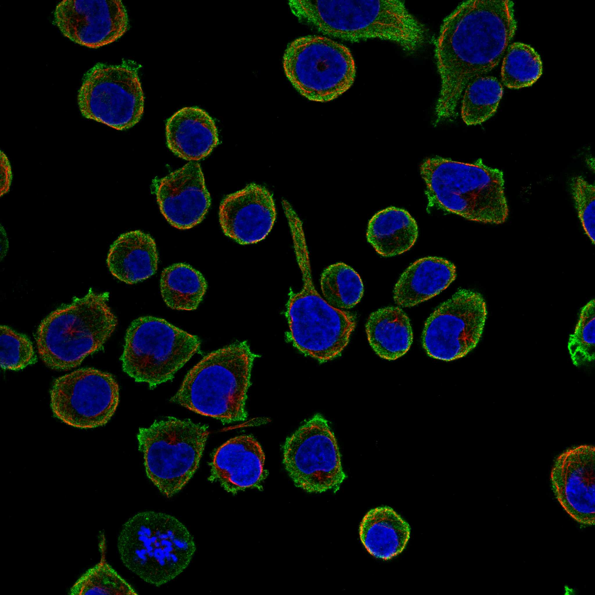 TRIB1 fluorescence