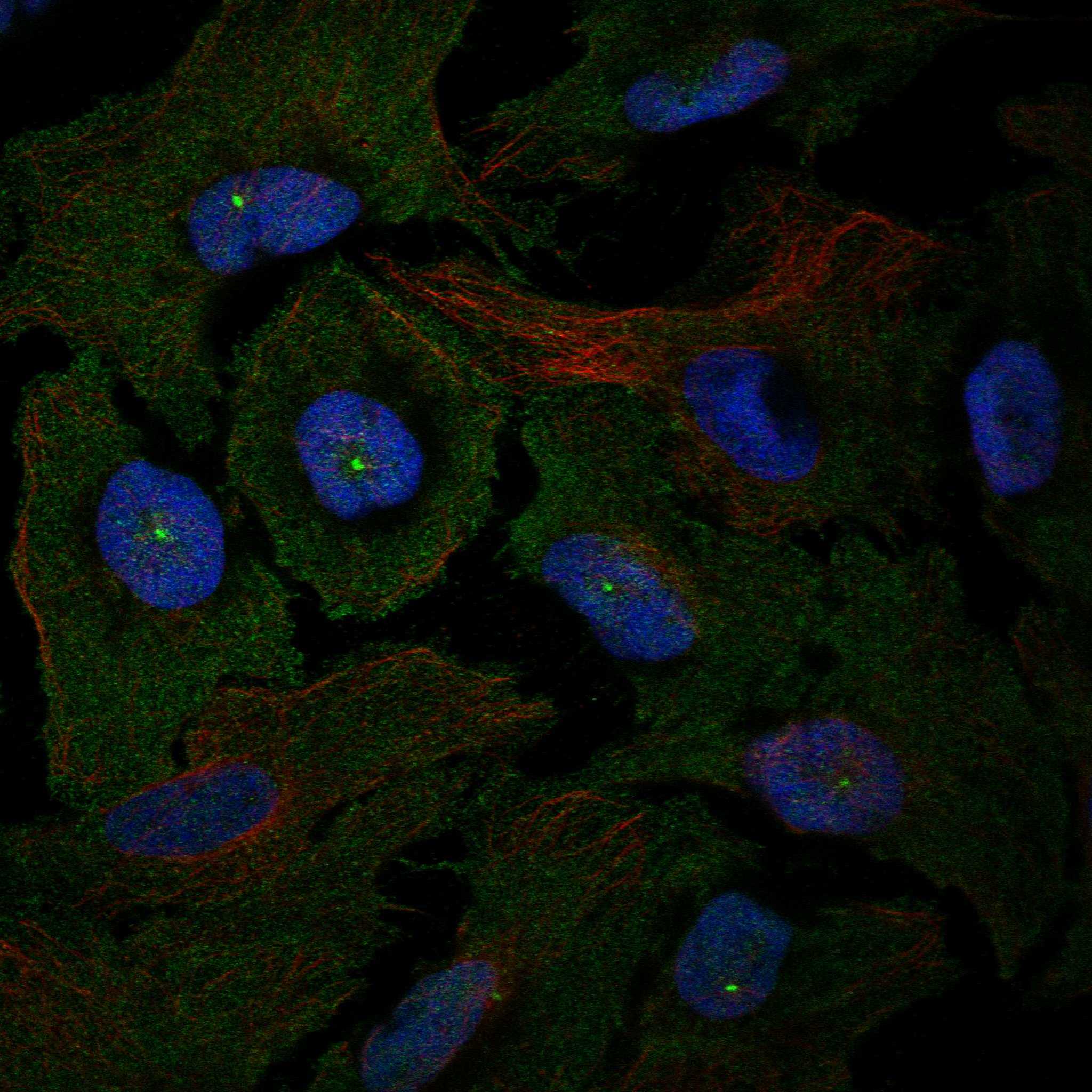 TRPM1 fluorescence