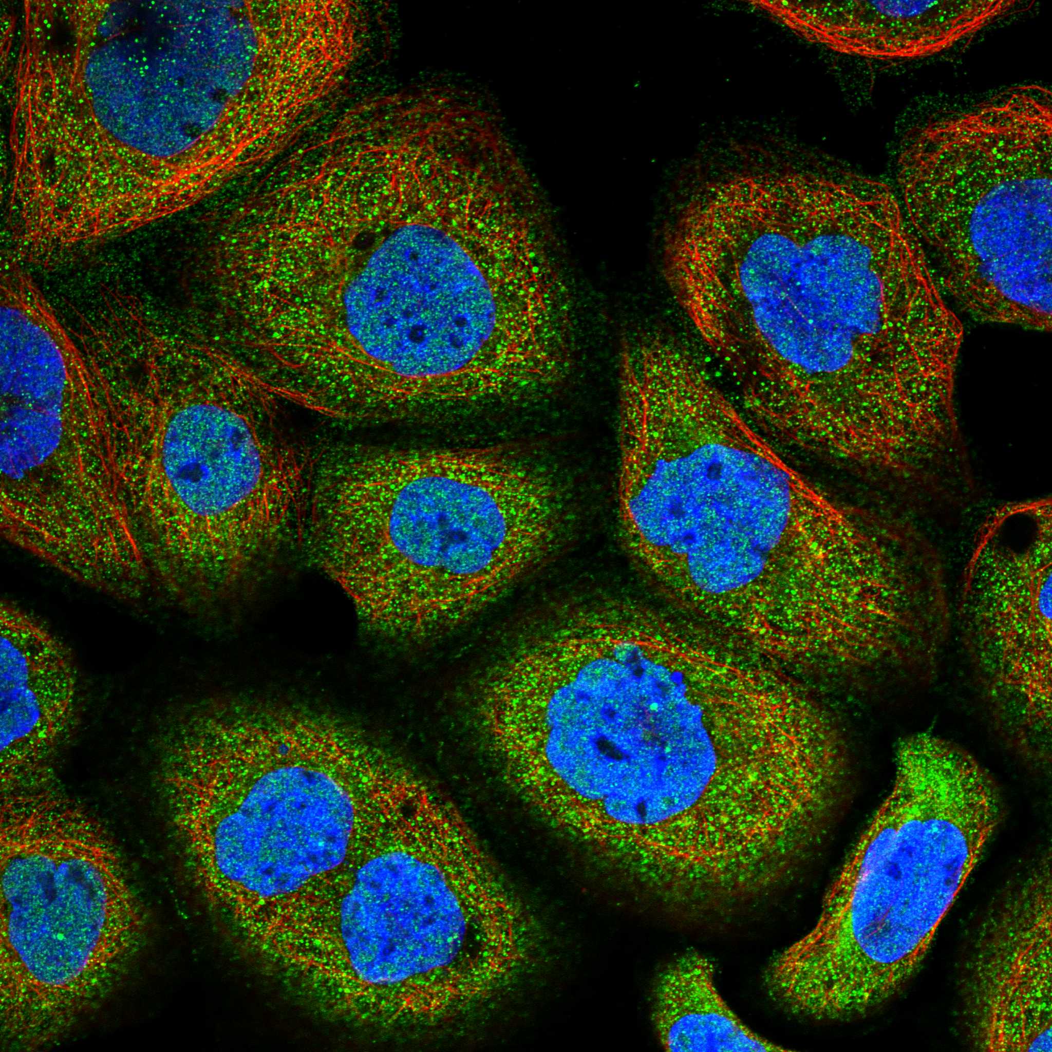 TRPM4 fluorescence