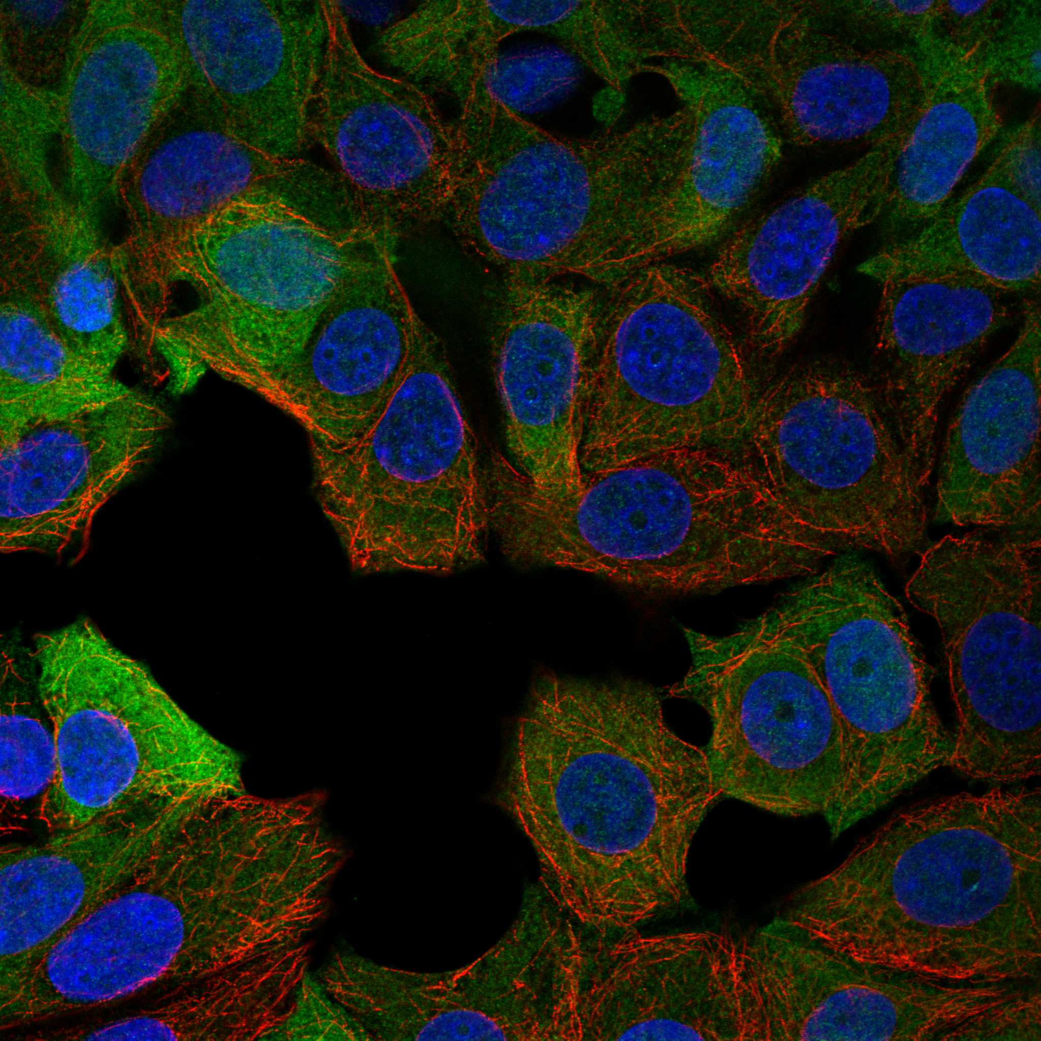 TRPM7 fluorescence